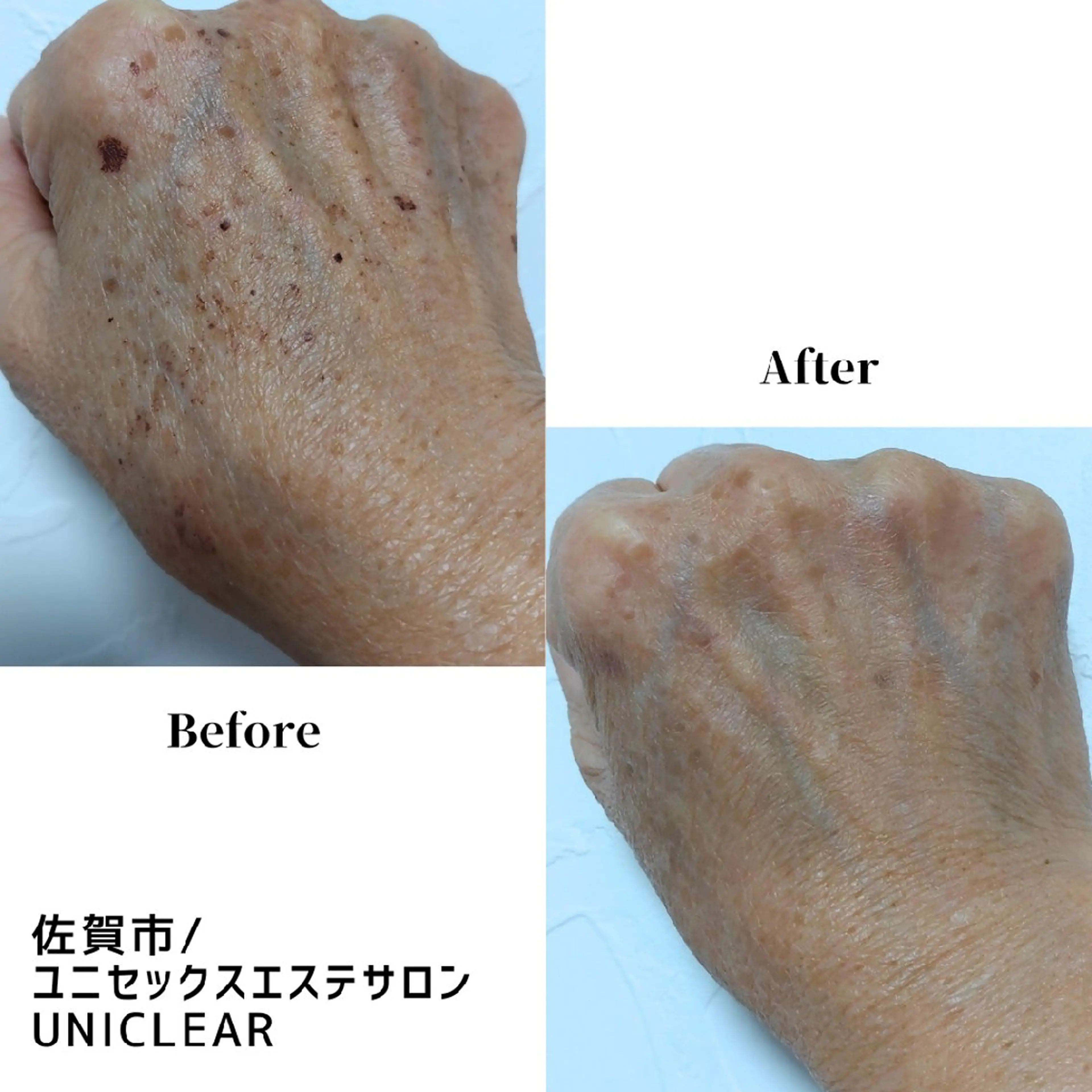 メンズ ユニセックスエステサロンUniclear所属・痩身&フェイシャル Uniclearのエステ・リラクイメージ