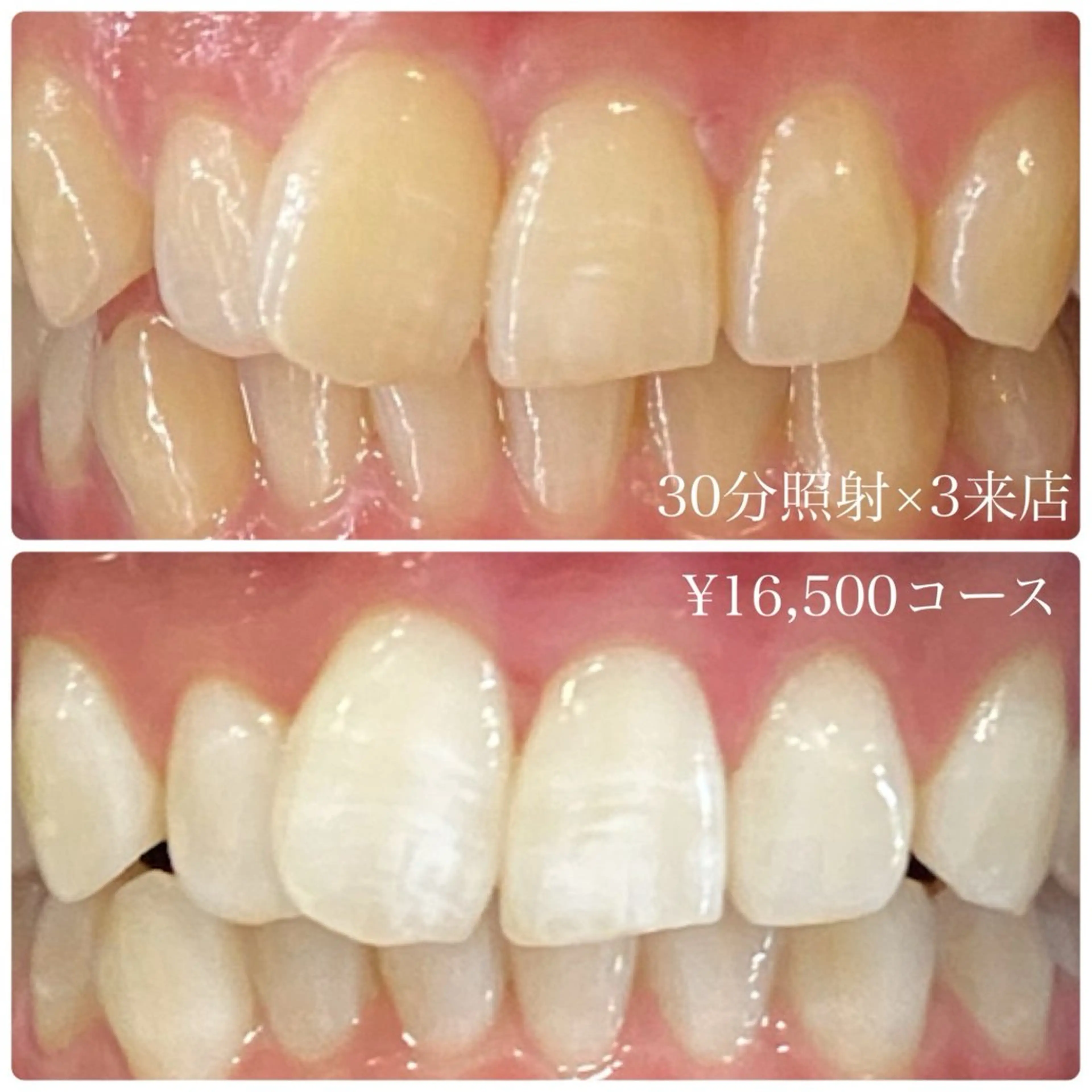 PLATINUM Beauty 横浜店所属・ホワイトニングルーム 横浜店のその他イメージ