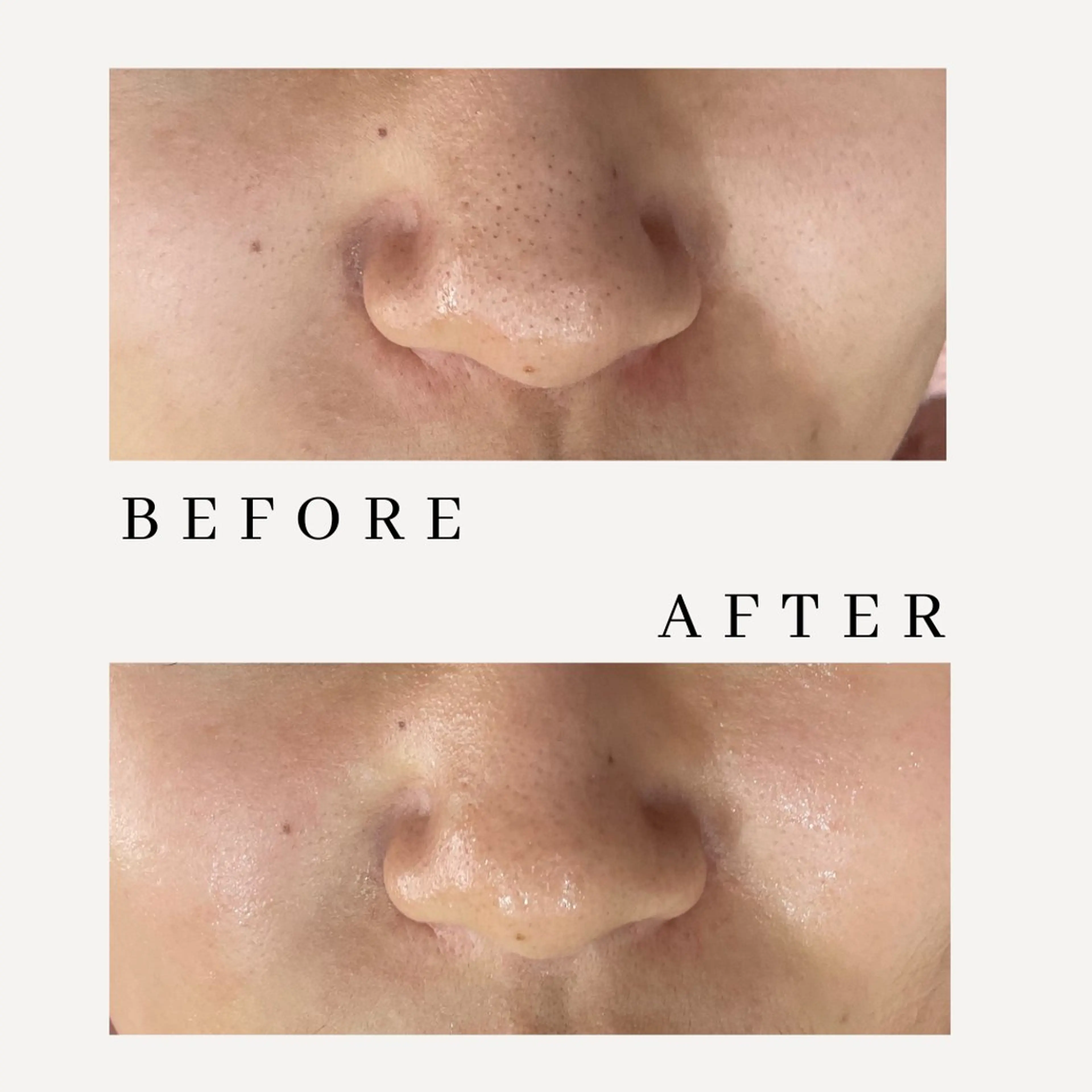 肌質改善専門サロン Bellmi/心斎橋のエステ・リラクイメージ