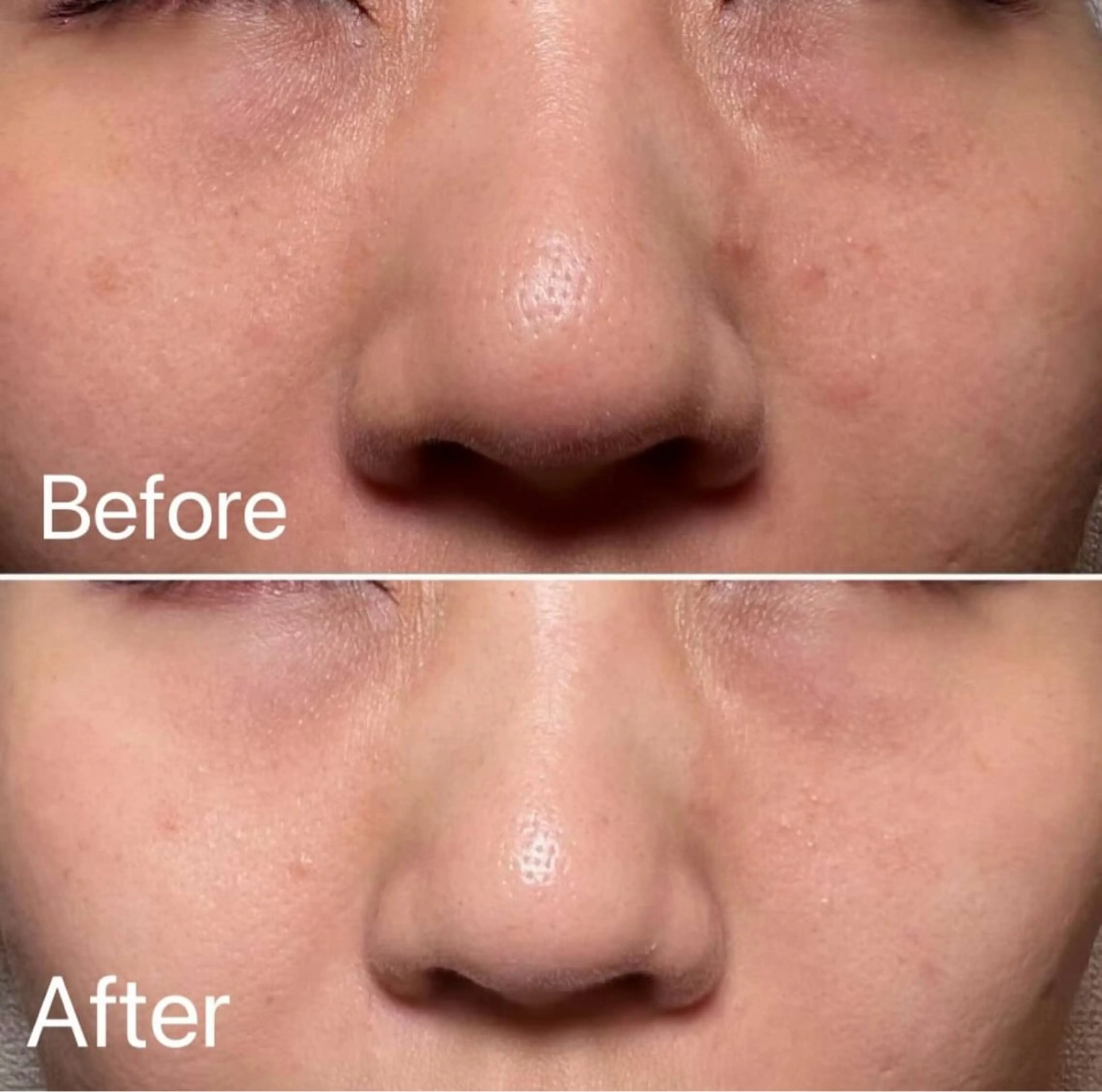 エステ ナスサロasuka. 🕯️🤎のエステ・リラクイメージ