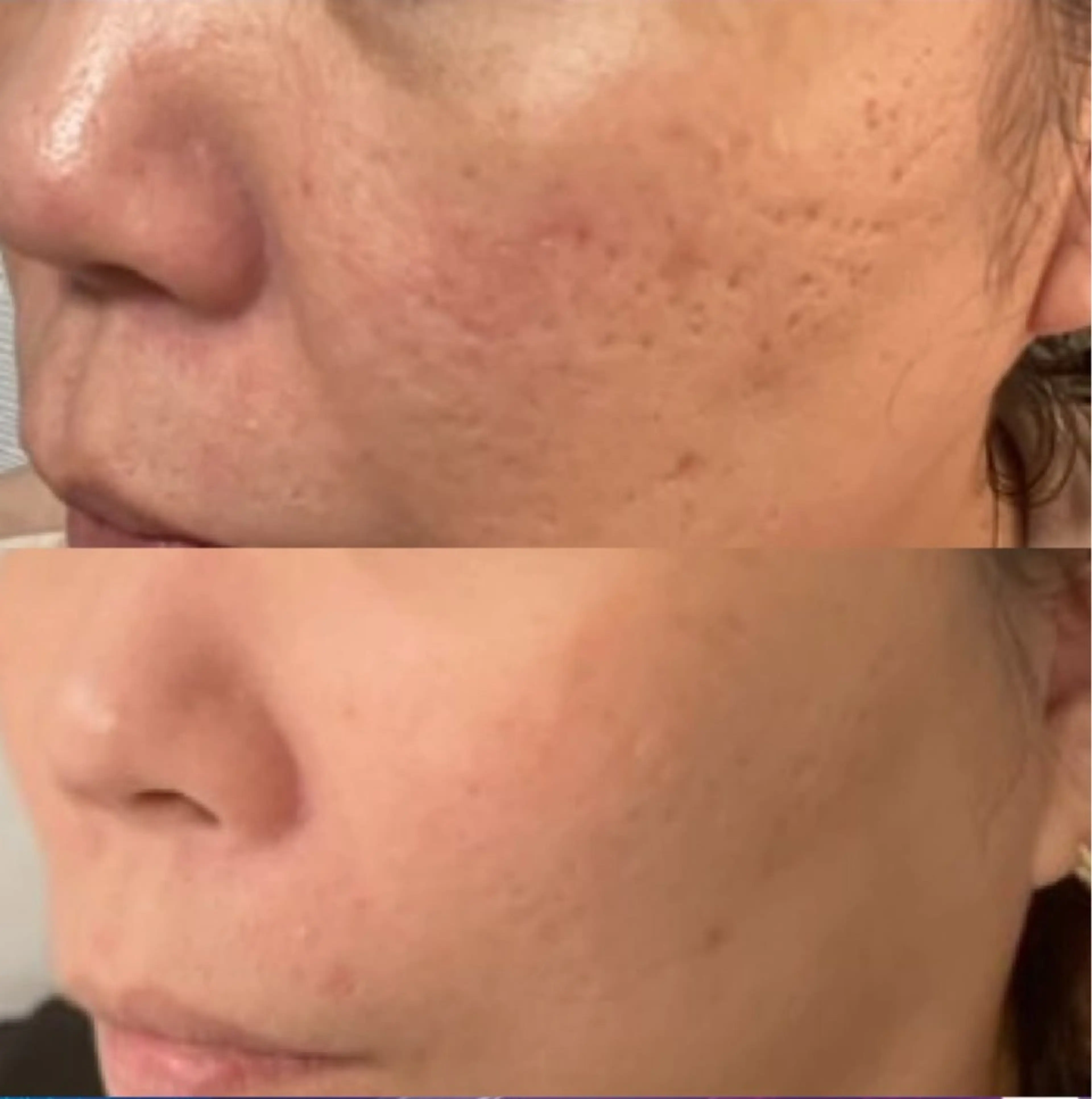 Blooming所属・LOUISE. ／肌質・頭皮のエステ・リラクイメージ