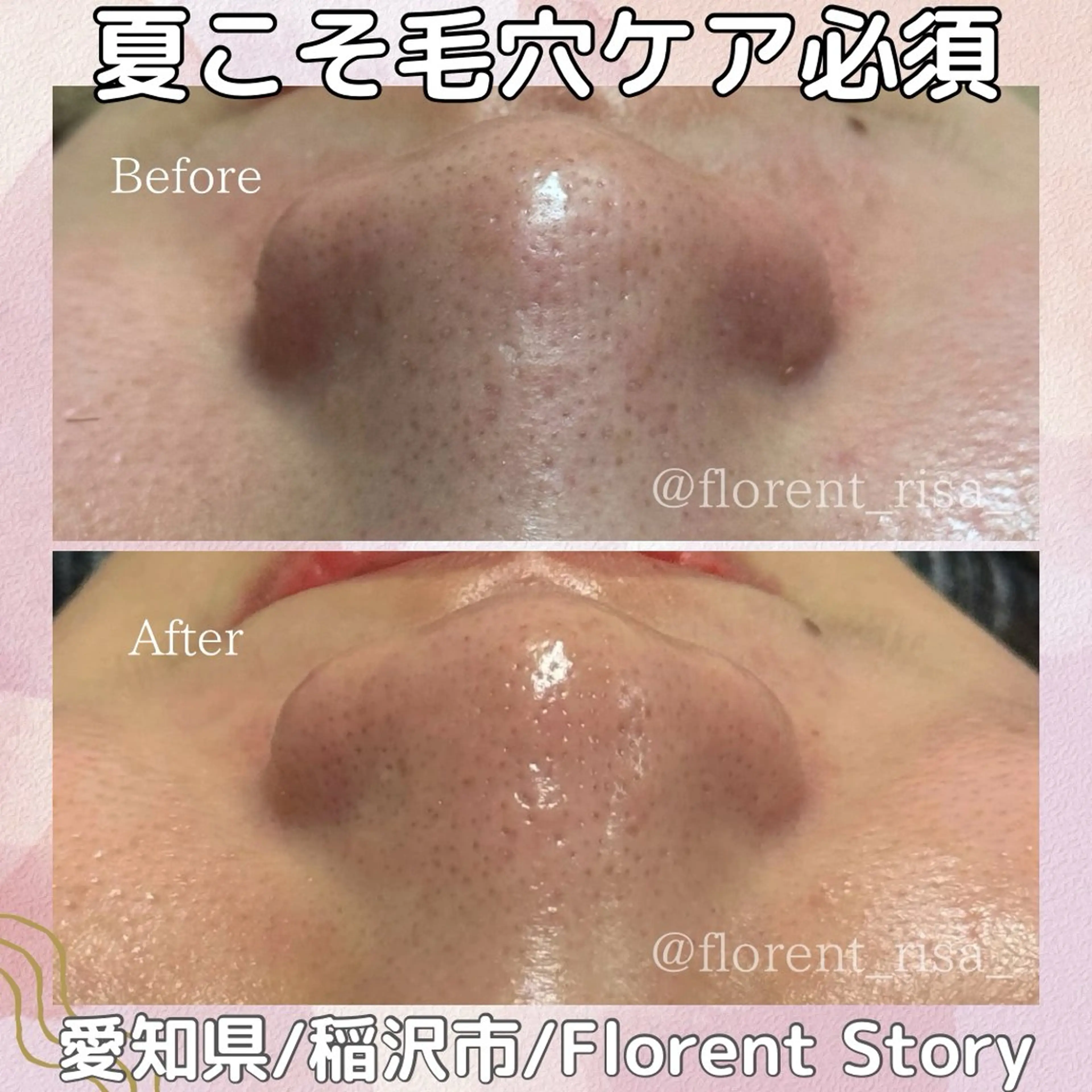 エステ 田中 里沙のエステ・リラクイメージ