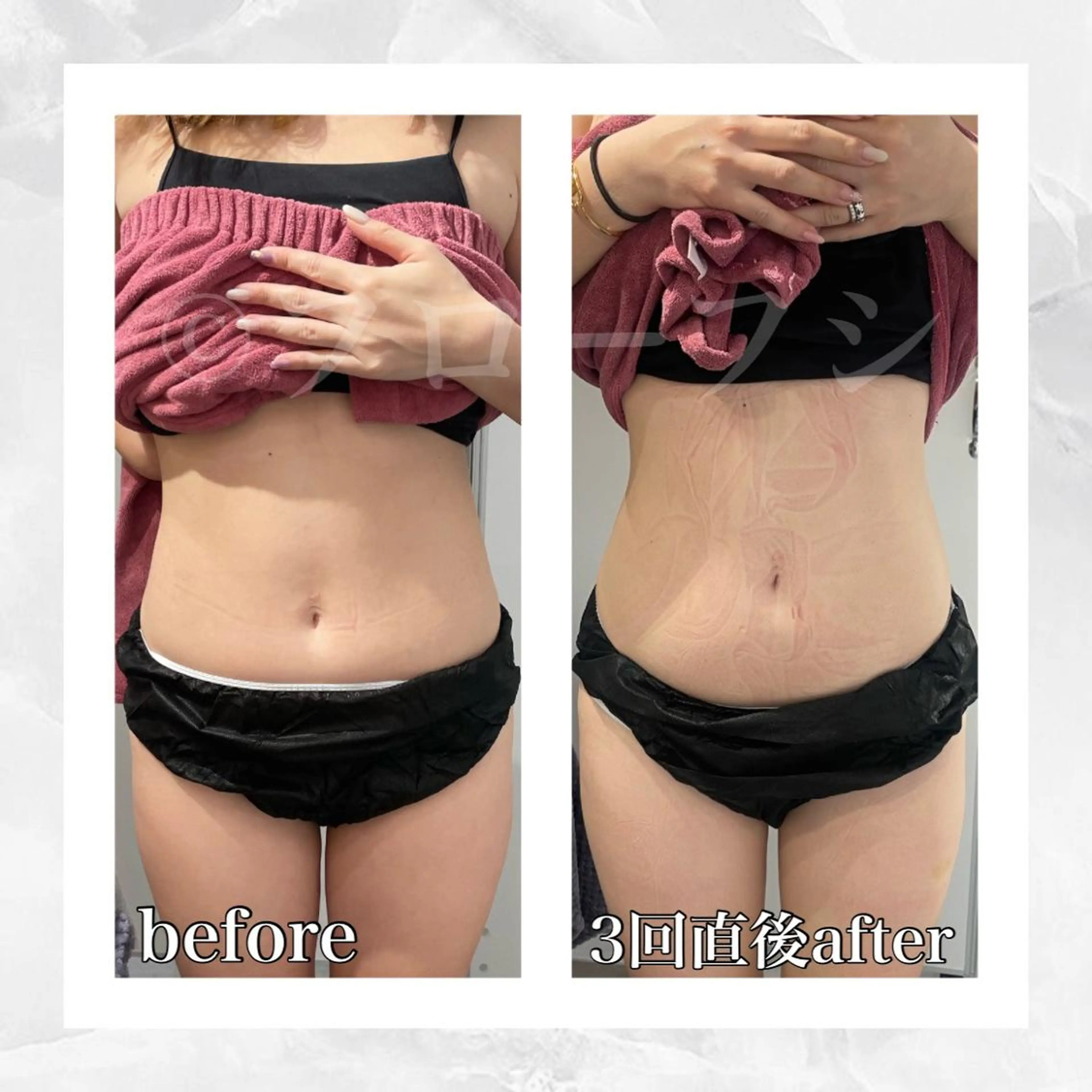 エステ リラク 部分痩せ♥️小顔専門 MIKUのエステ・リラクイメージ