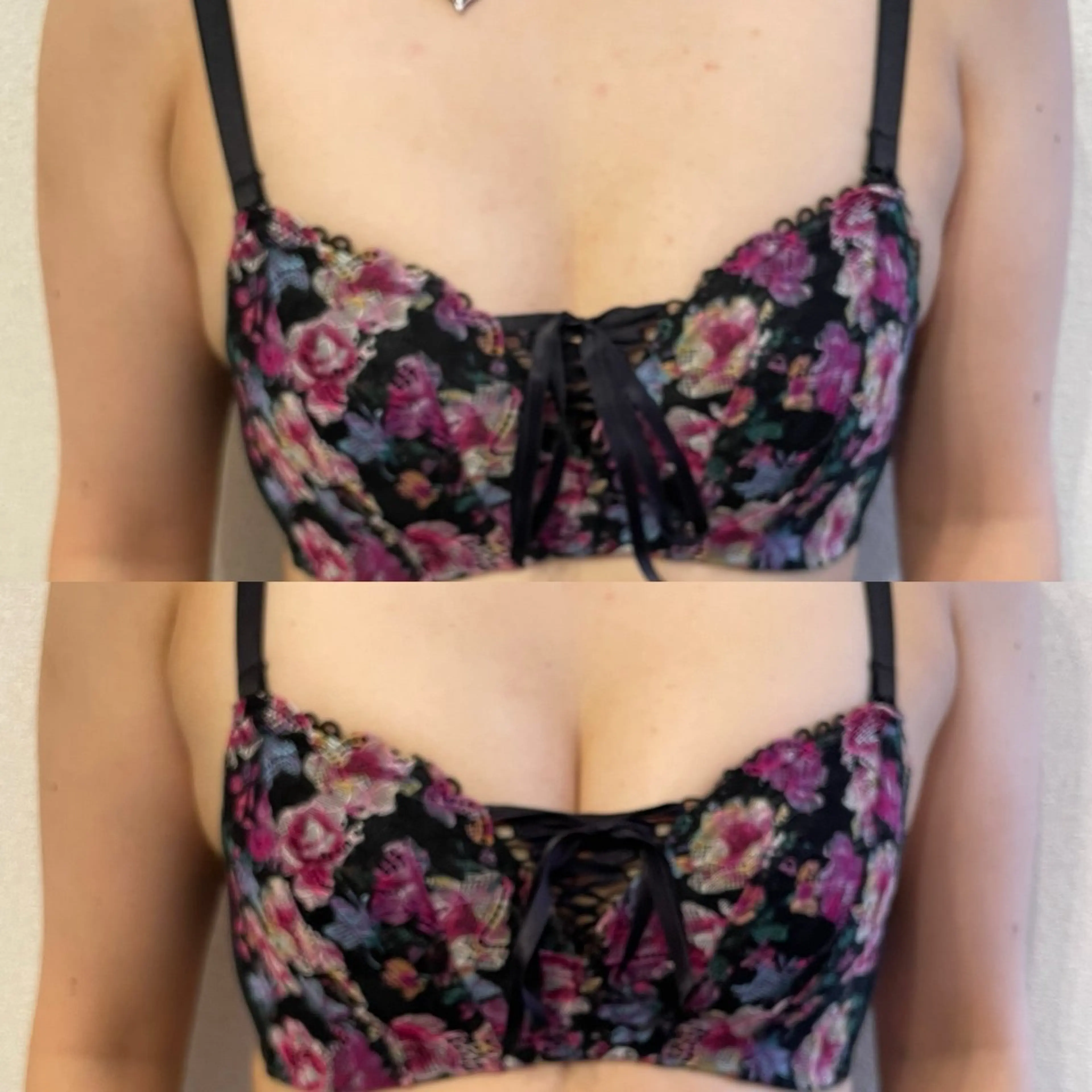 Beauty Salon HaRuのエステ・リラクイメージ