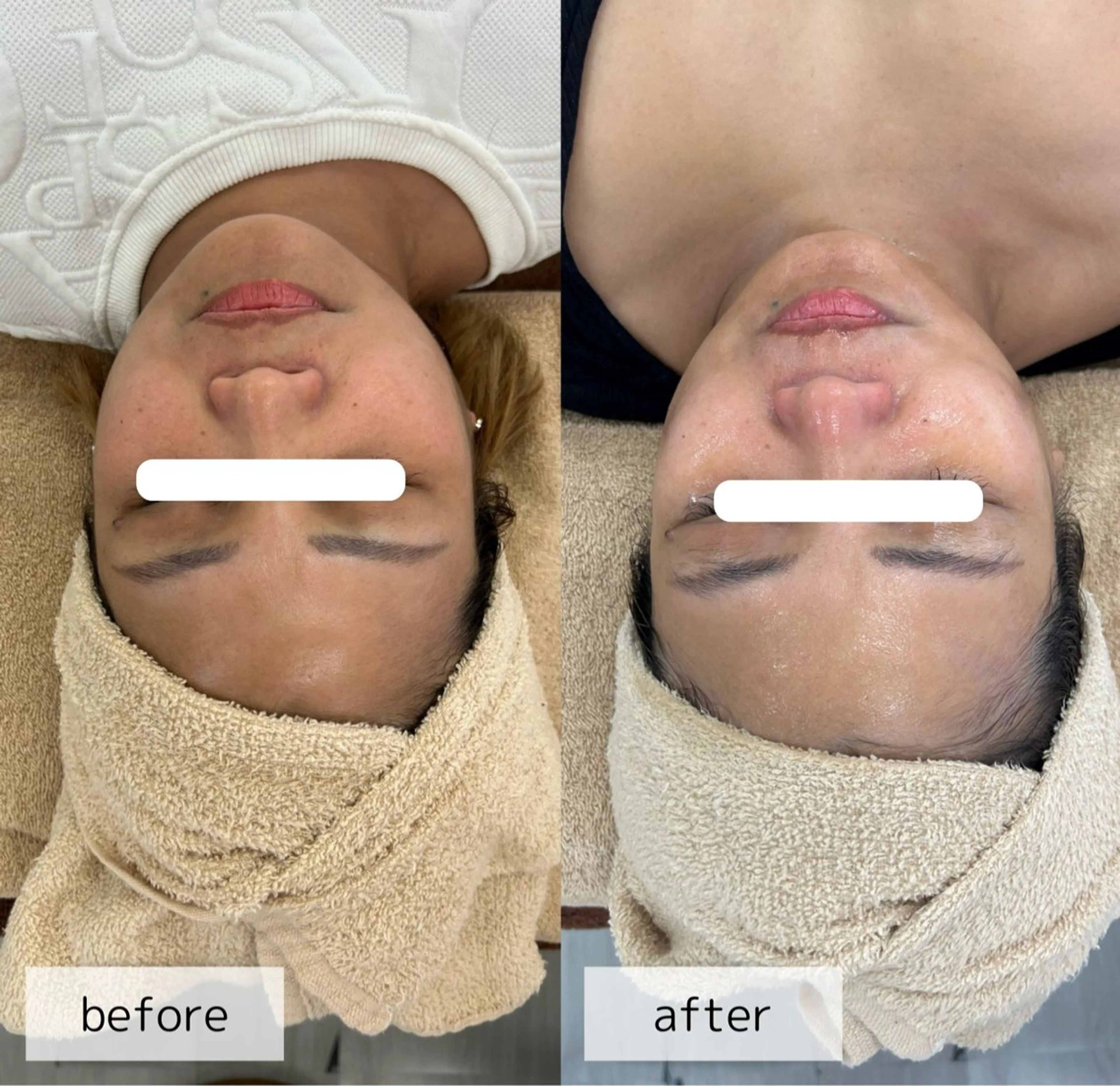 エステ Venus所属・エステサロン Venusのその他イメージ