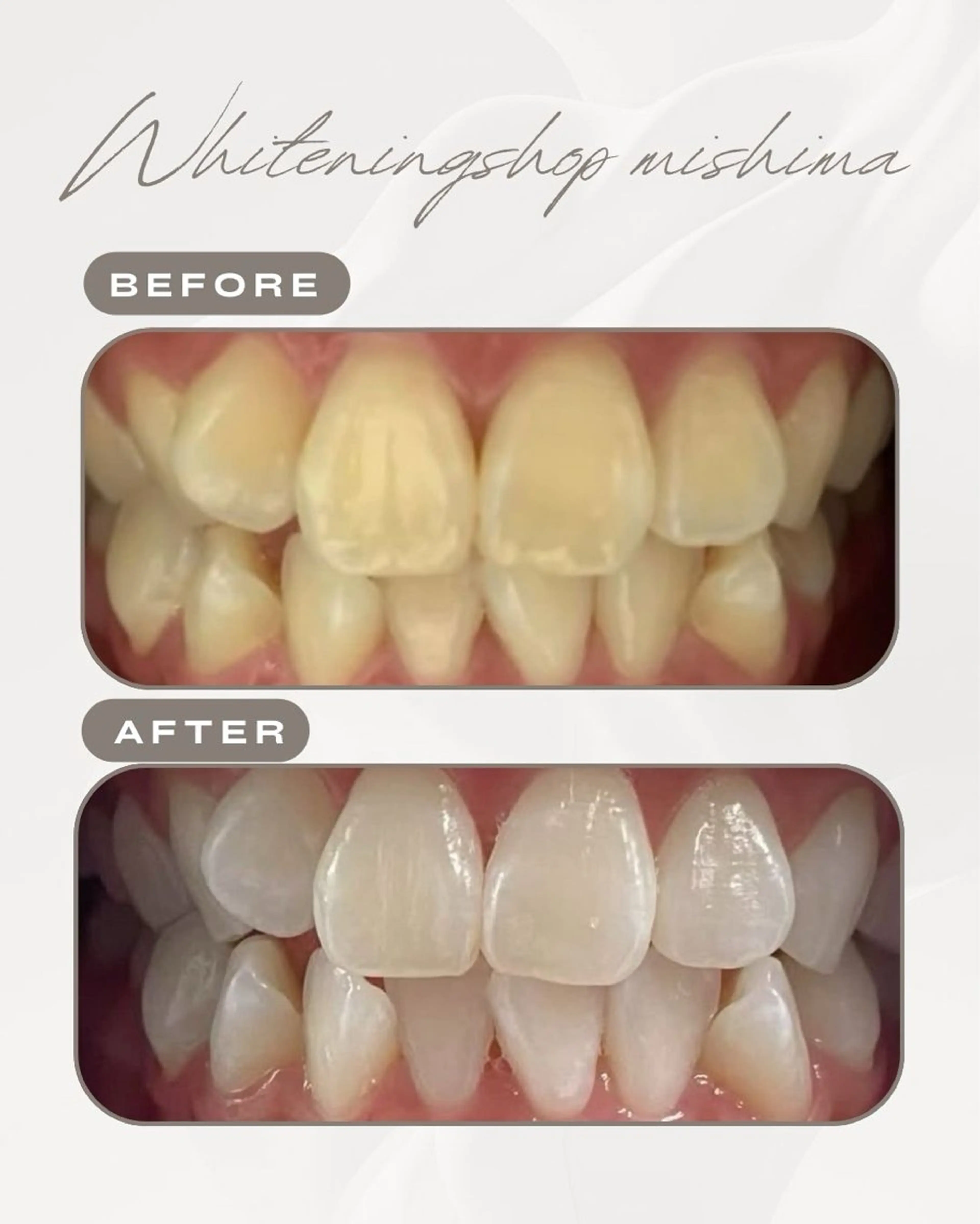 ホワイトニングショップ 三島店所属・ホワイトニング ショップ三島店のその他イメージ