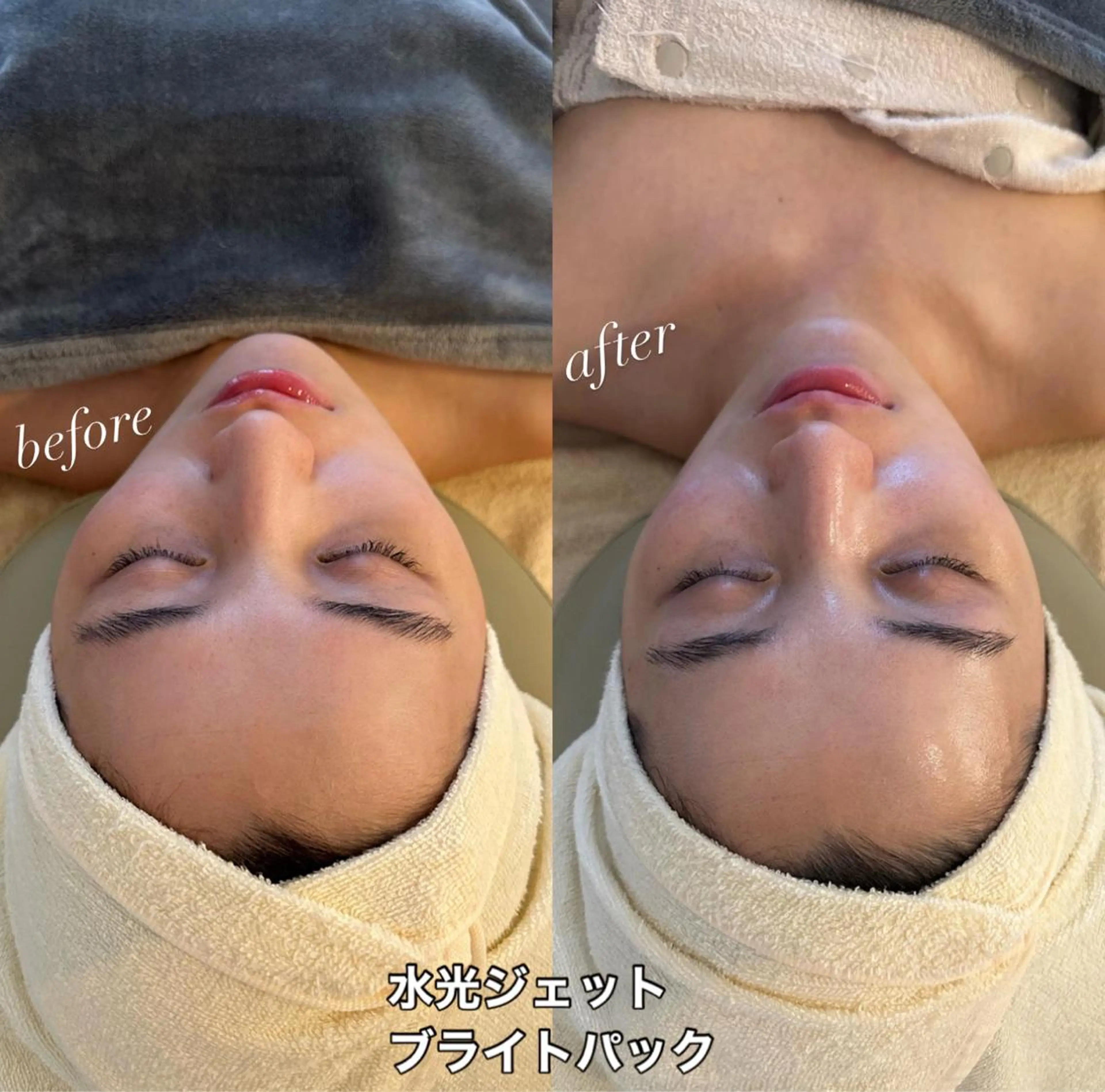 うなじ脱毛/美肌脱毛 LABELのエステ・リラクイメージ