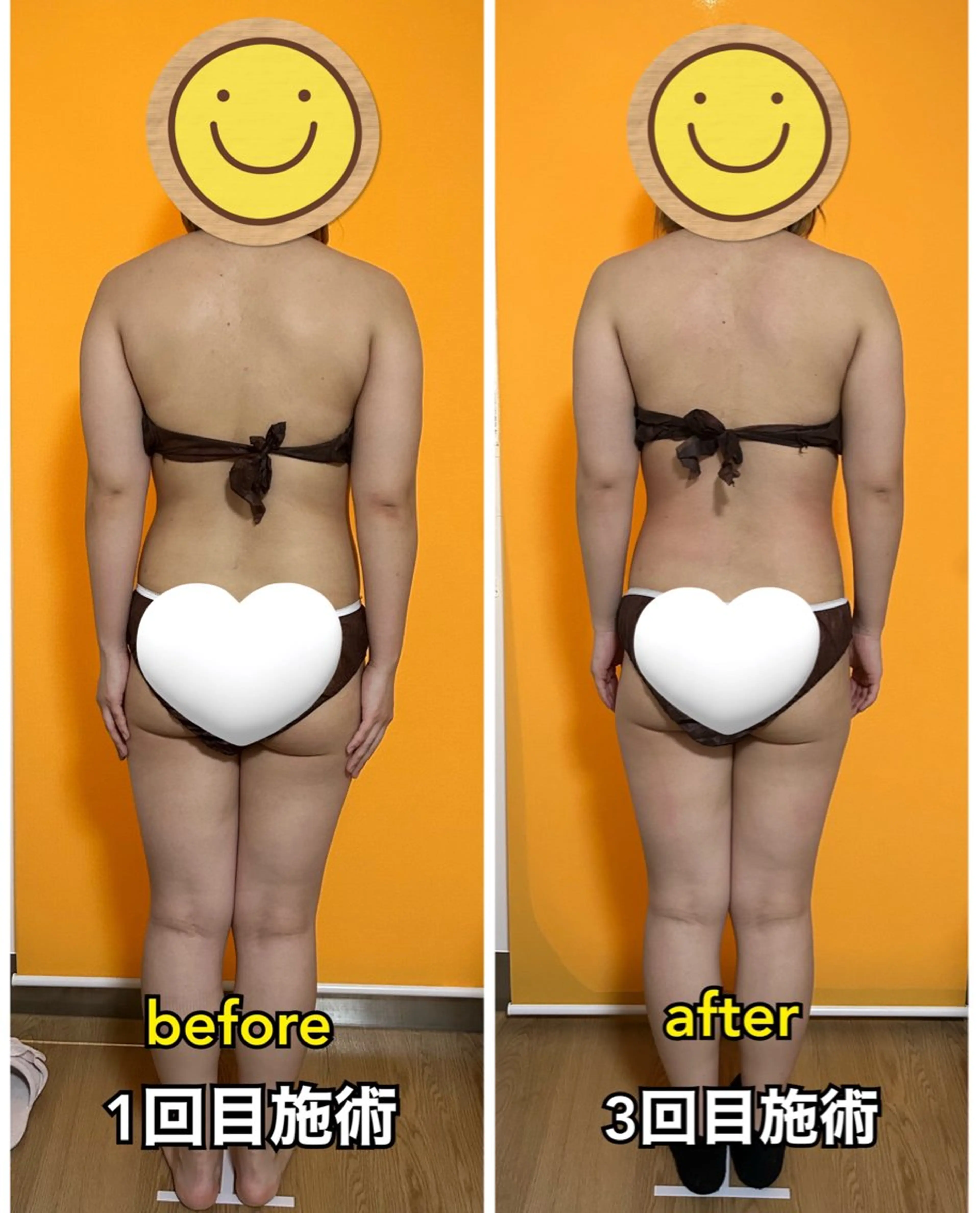 クリスマスまでに痩せなきゃ！背中ムチムチ！ぽっこりお腹を3回でなんとかします！骨盤矯正➕全身痩身マッサージ！の写真