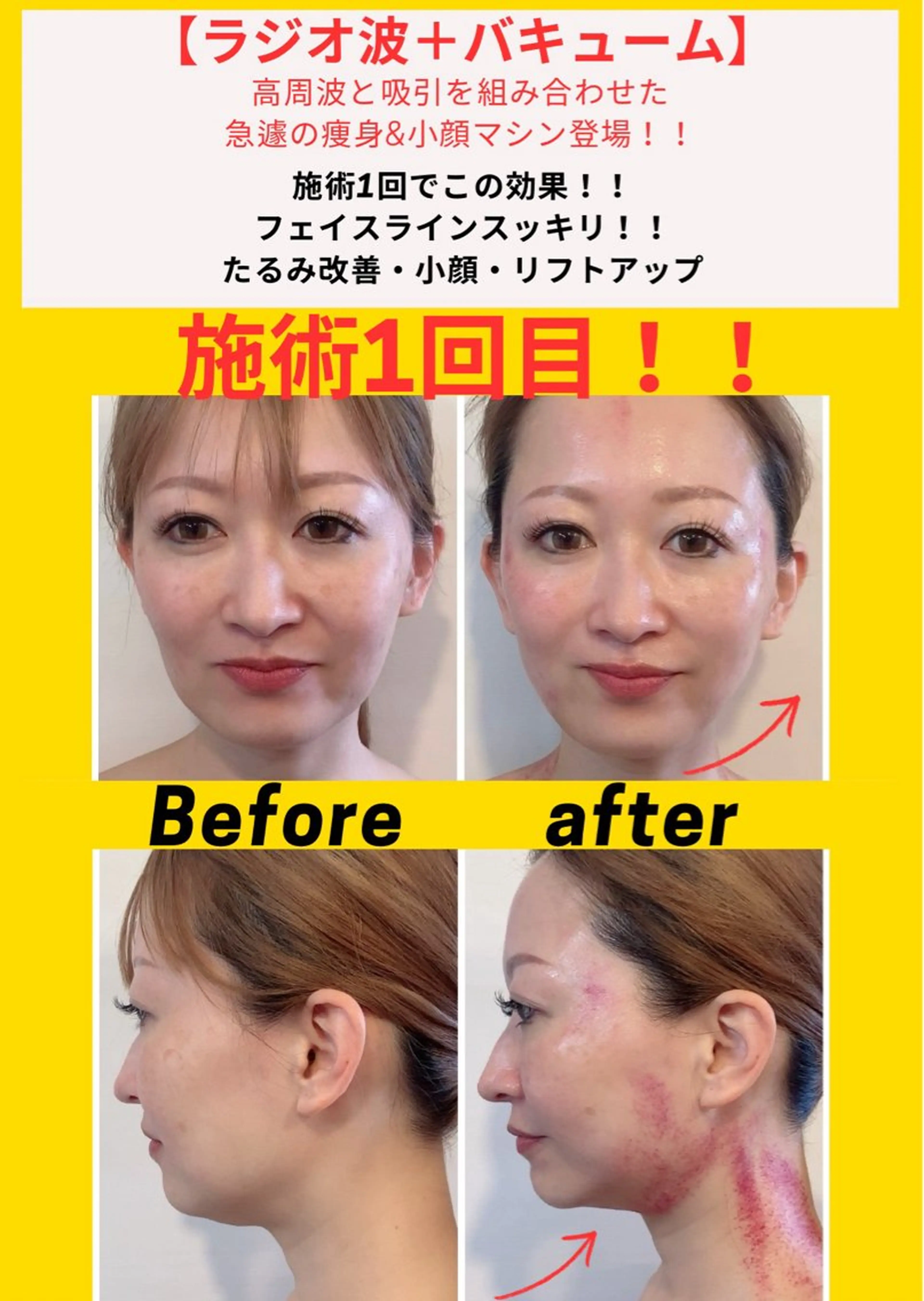 毛穴フェイシャル エステ専門店BBのエステ・リラクイメージ