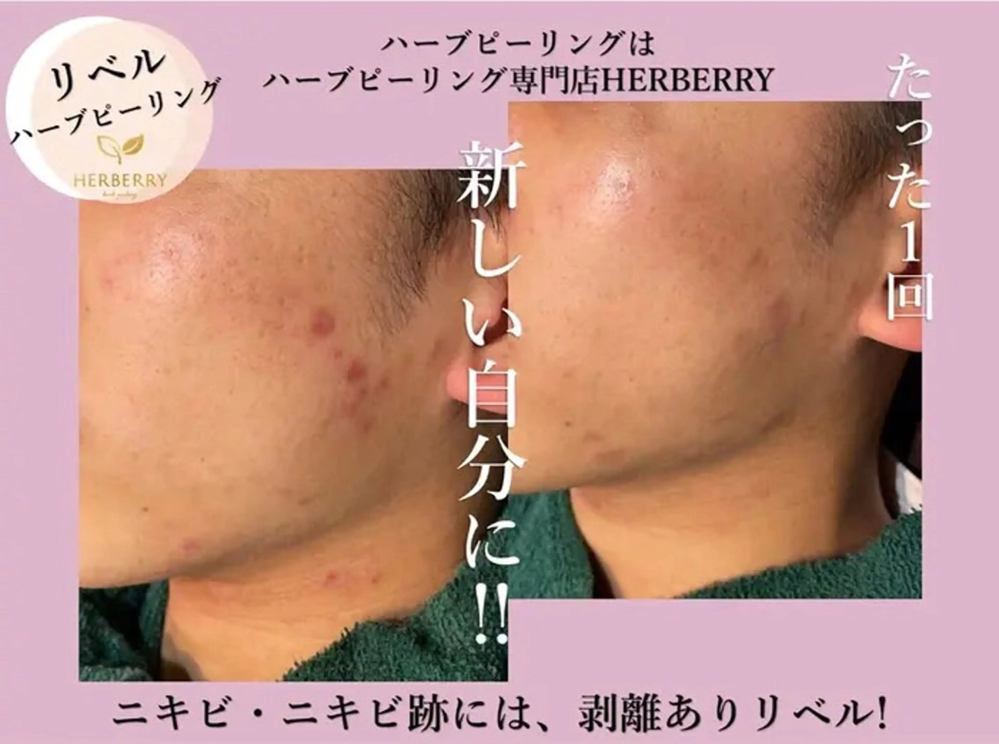 ハーブピーリング専門店HERBERRY難波心斎橋店所属・ハーブピーリング専門 HERBERRY冨永のエステ・リラクイメージ