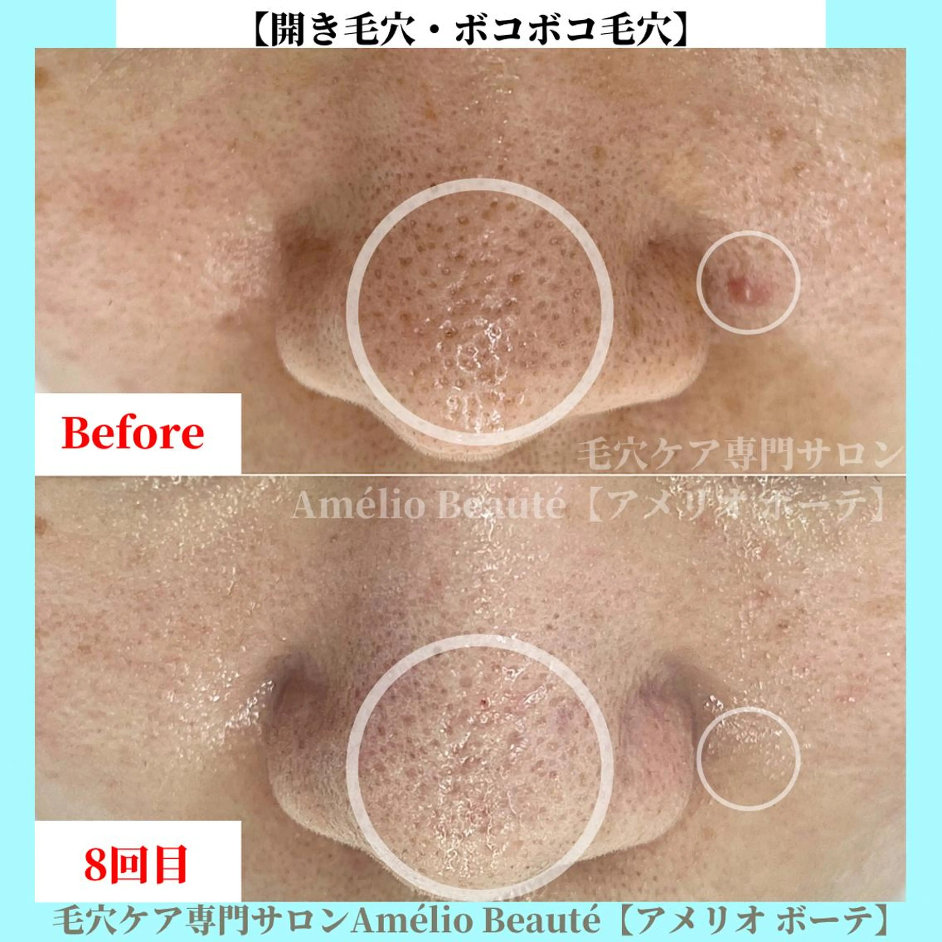 毛穴ケア専門サロン Amélio Beauté所属・毛穴ケア専門サロン アメリオボーテのその他イメージ