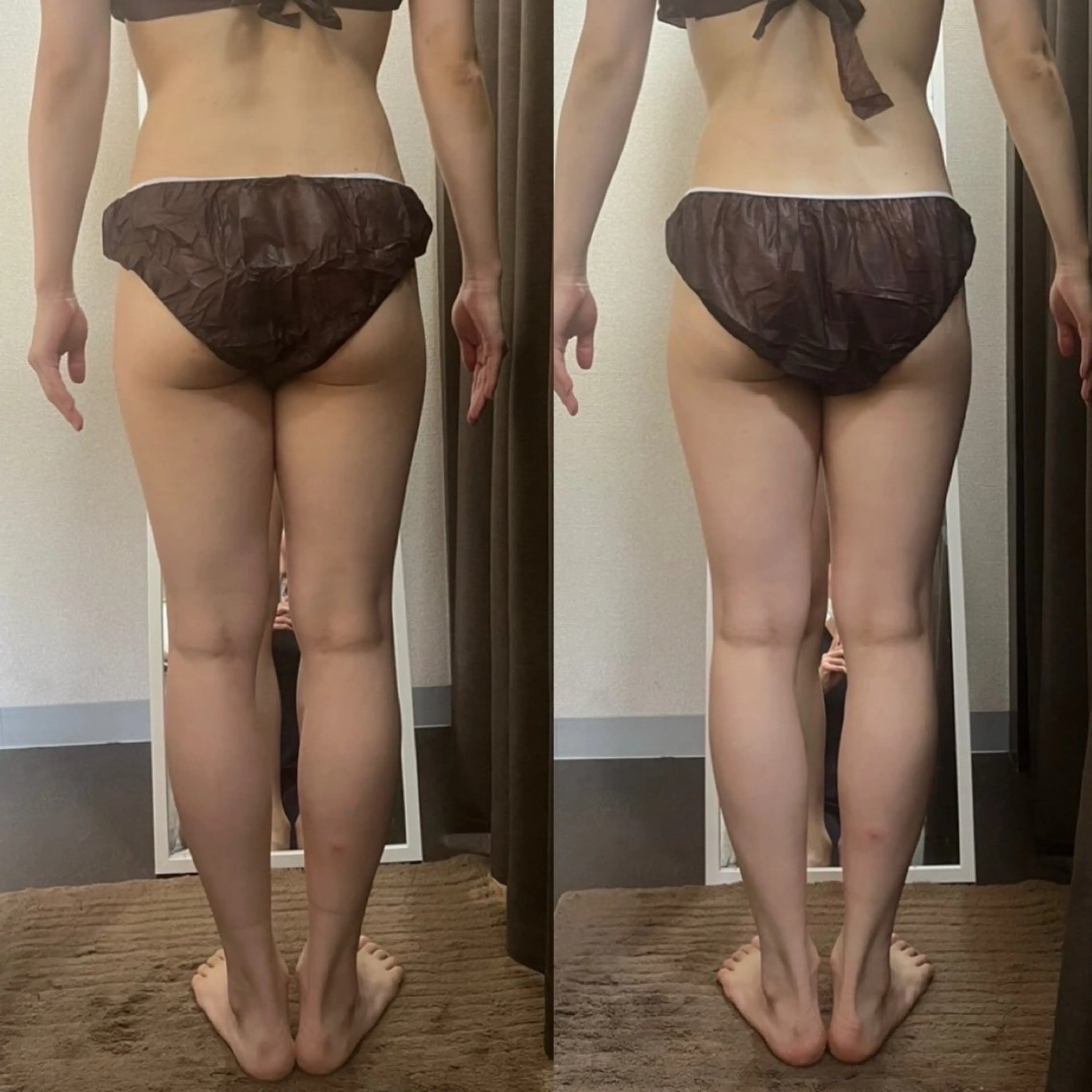 エステ ハイパーナイフ専門店　Salon de COCO所属・Salon de COCOのエステ・リラクイメージ