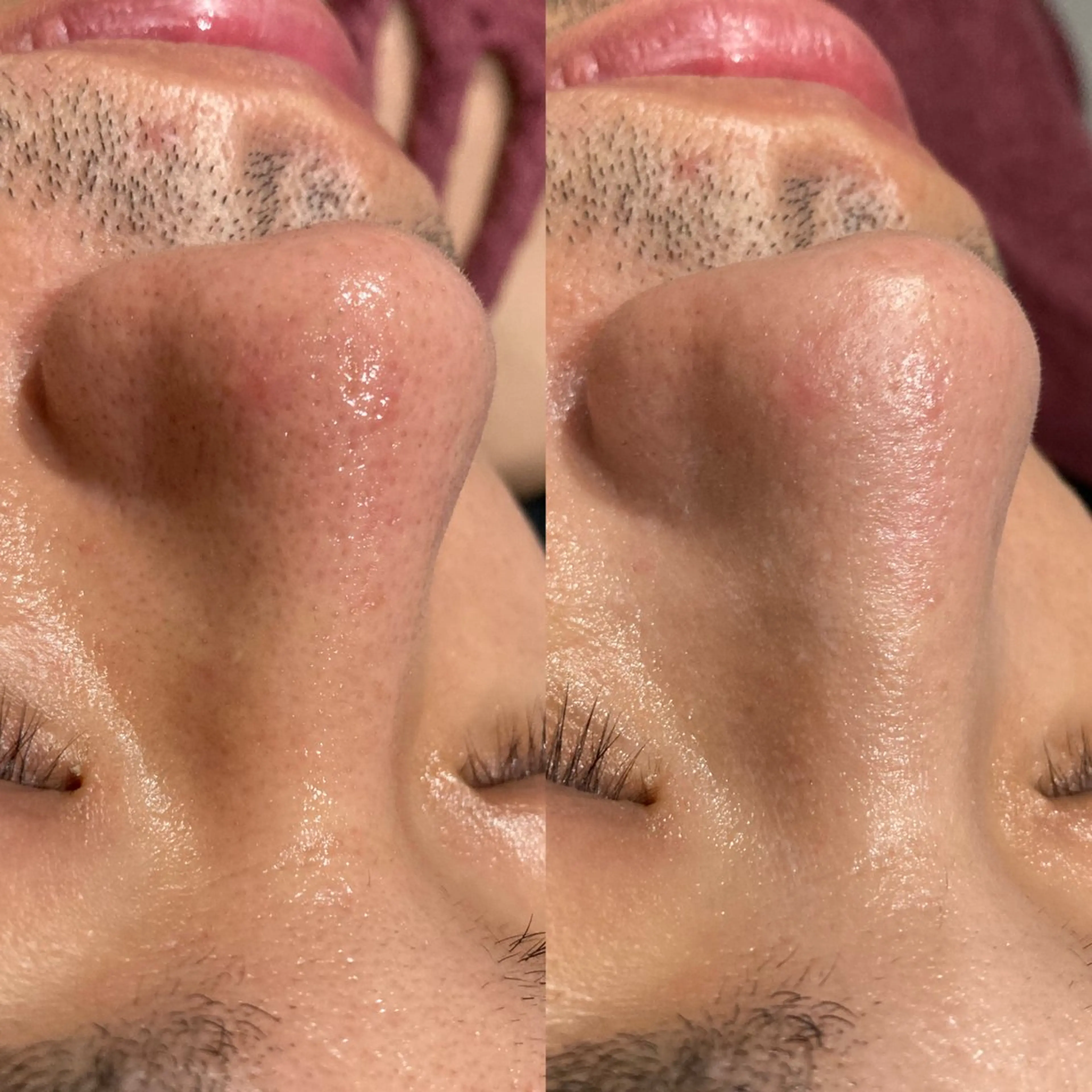 エステ NANI OAFU所属・NANIOAFU [なんば店］のその他イメージ