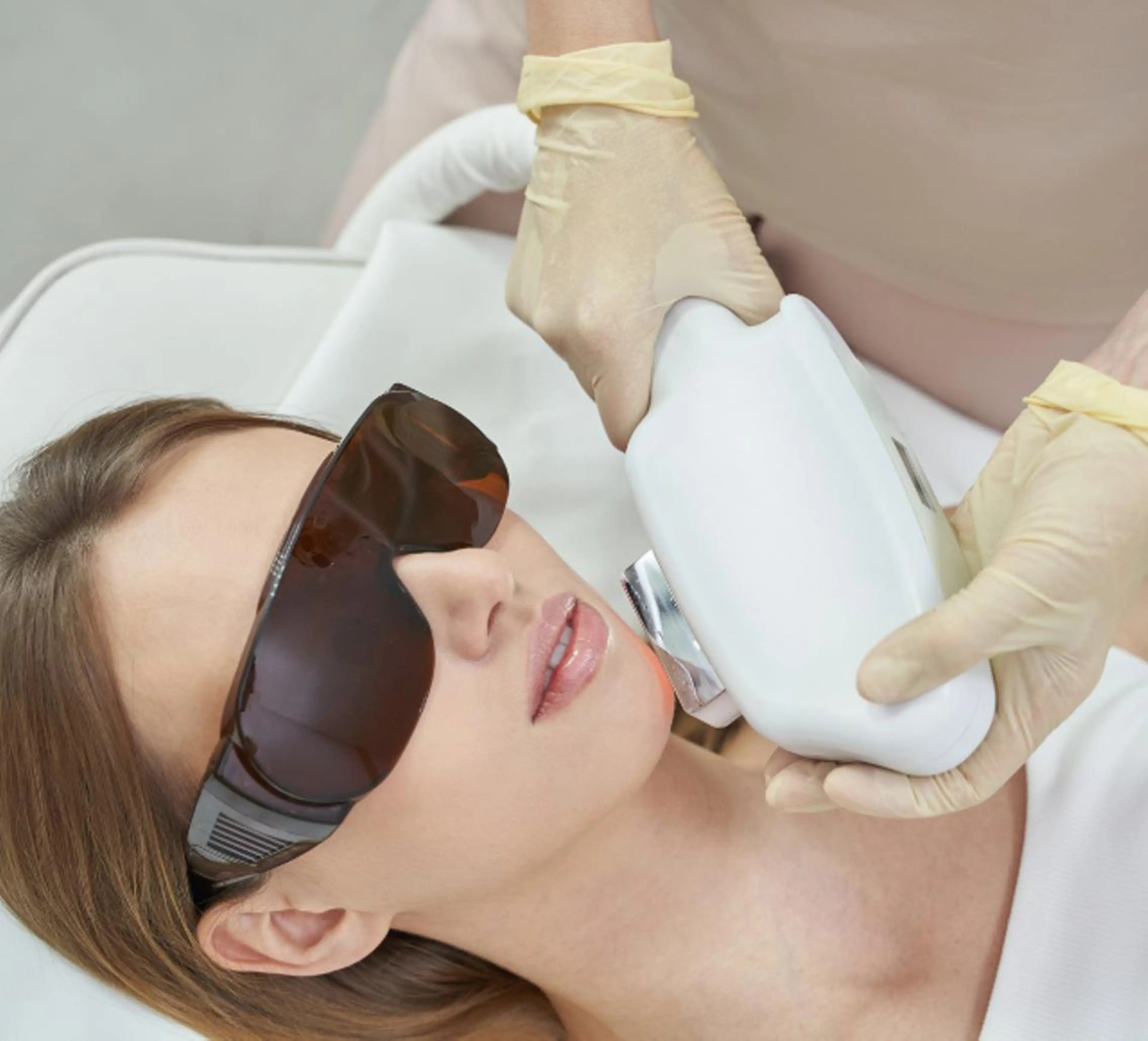 IPL光フェイシャル【全顔】悩みに合わせた４モードの写真