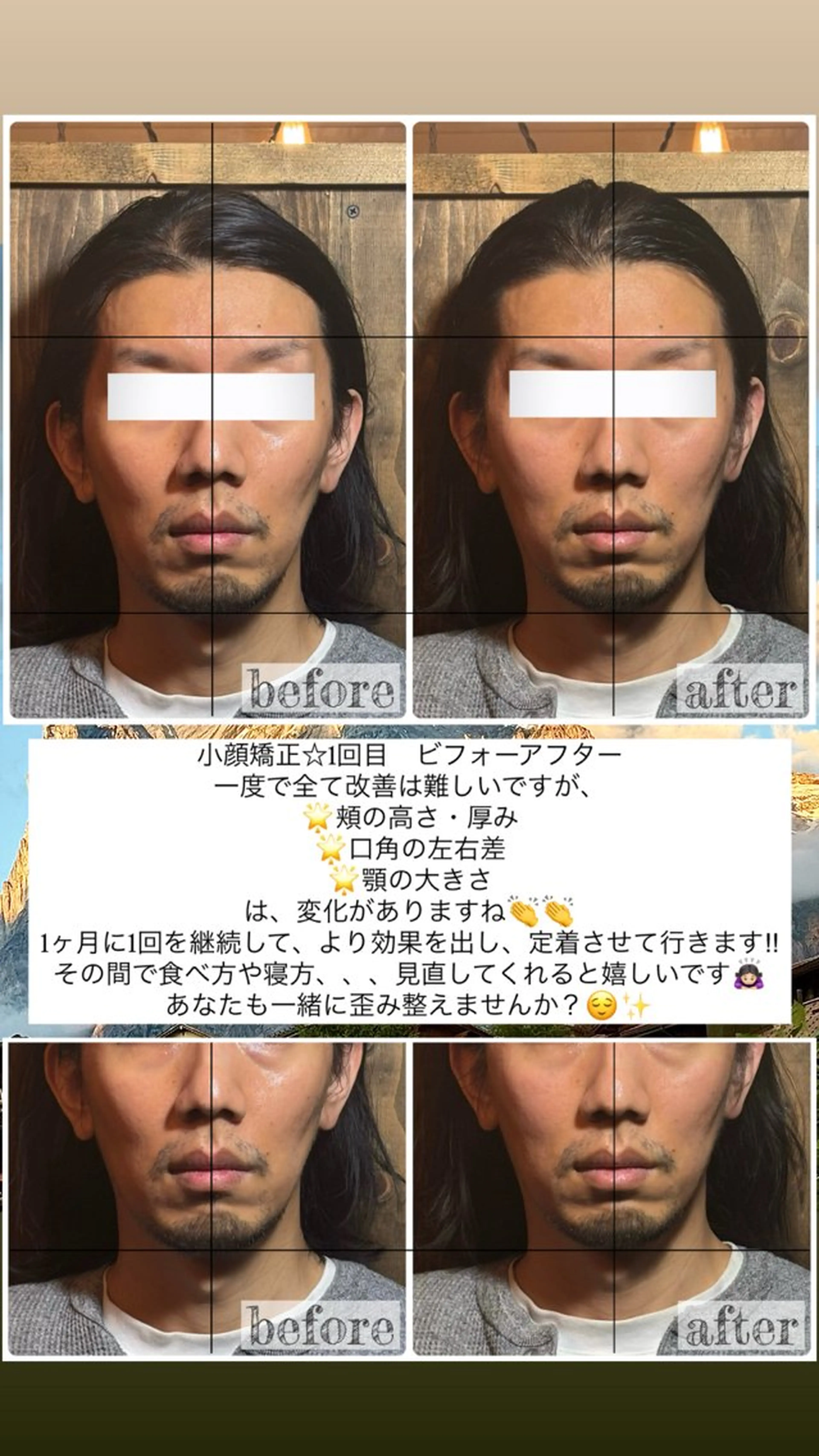 エステ リラク 💎後悔させない小顔 矯正💎イトヤマ🌱のエステ・リラクイメージ