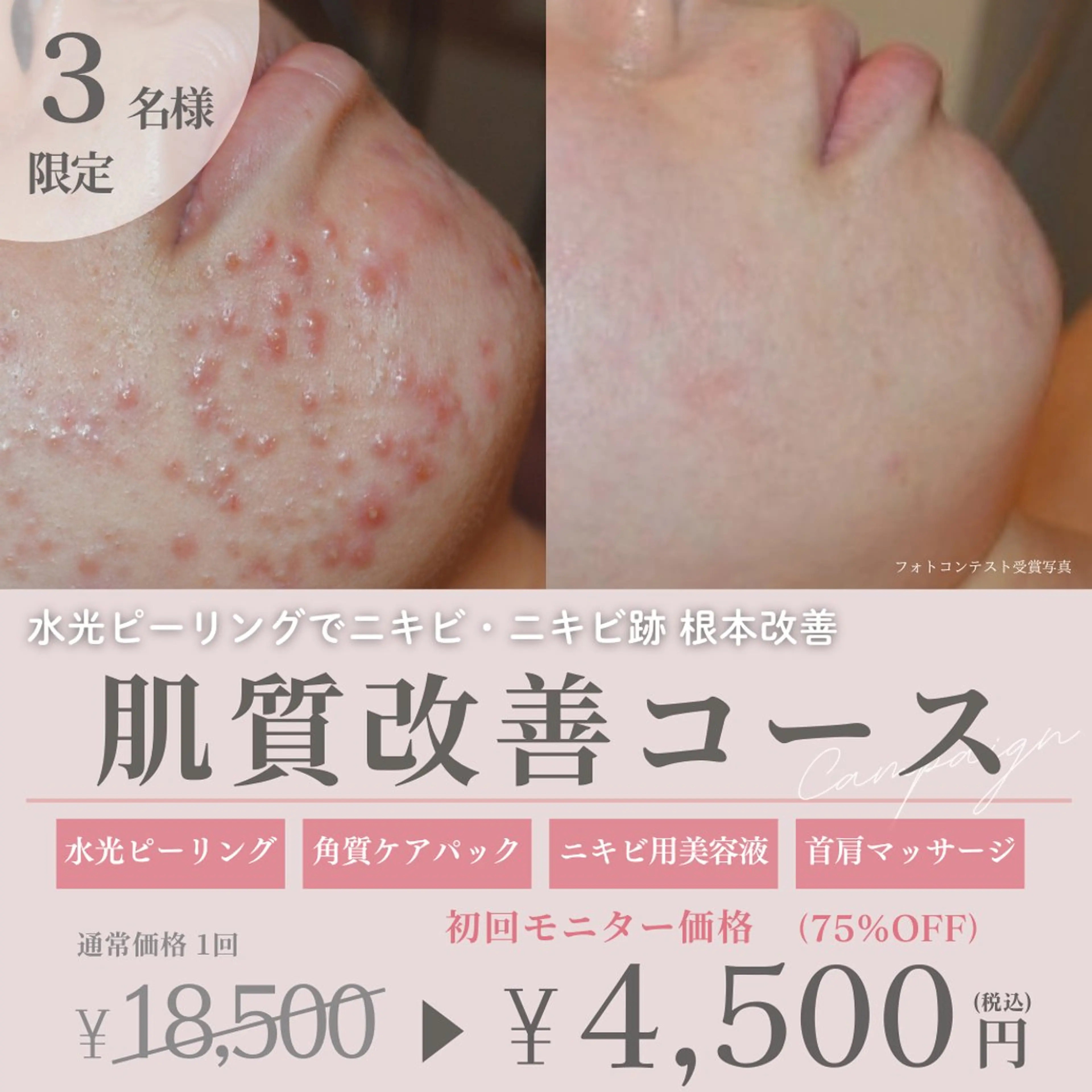 エステ 肌質改善サロン LesFleursのエステ・リラクイメージ