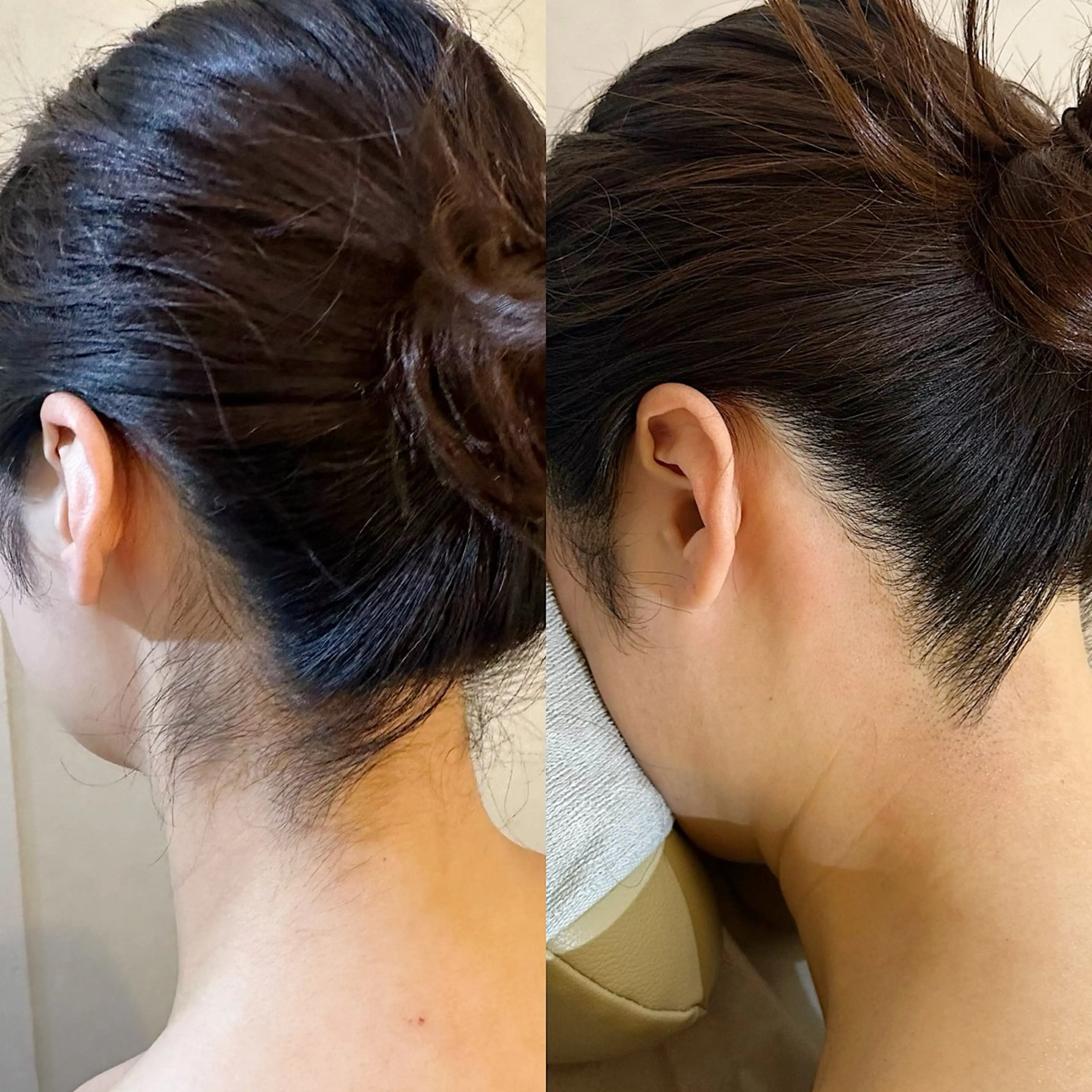 脱毛 うなじ脱毛/美肌脱毛 LABELのエステ・リラクイメージ