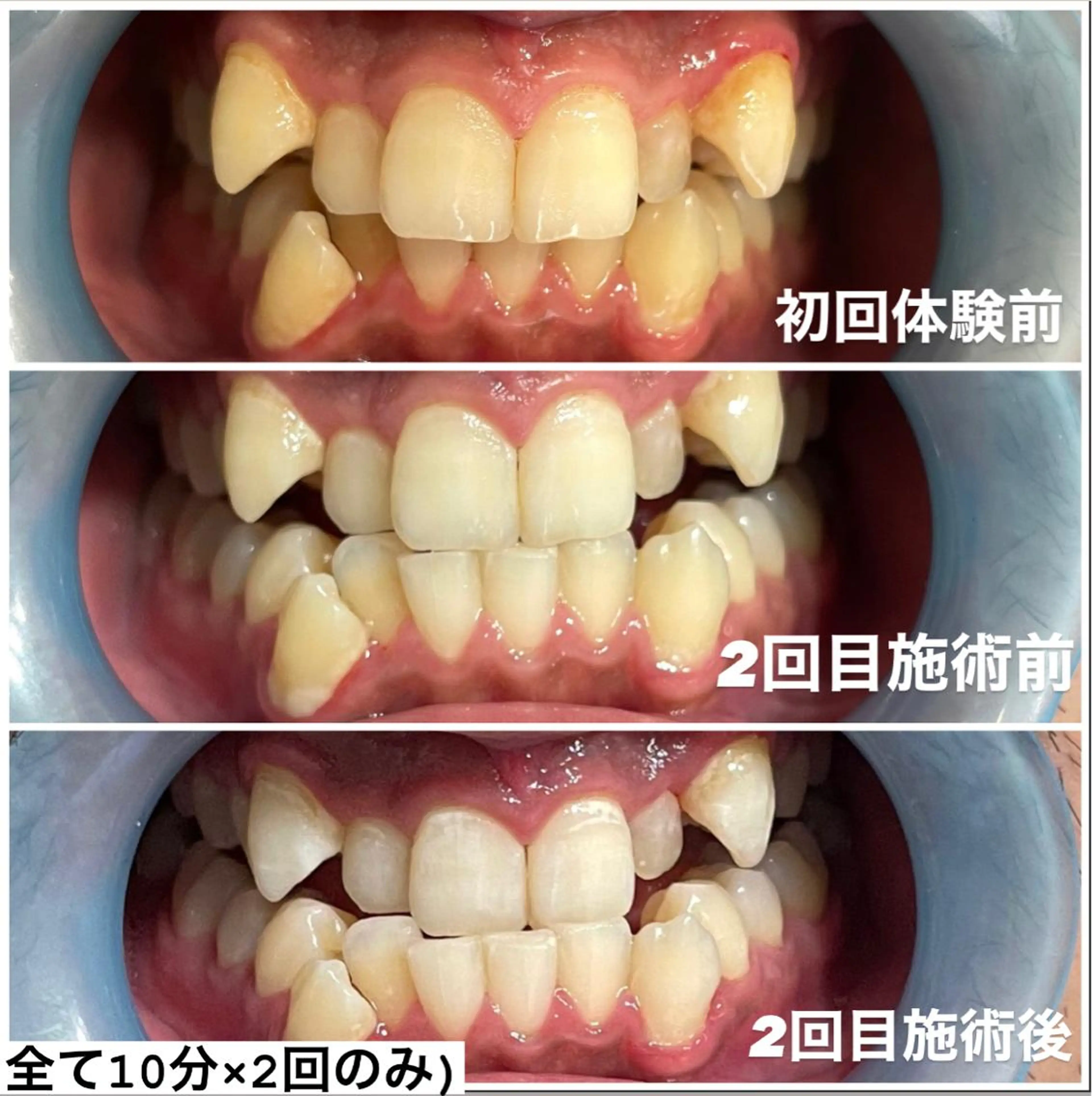 その他 ホワイトニング専門店 Hi-Whiteのその他イメージ