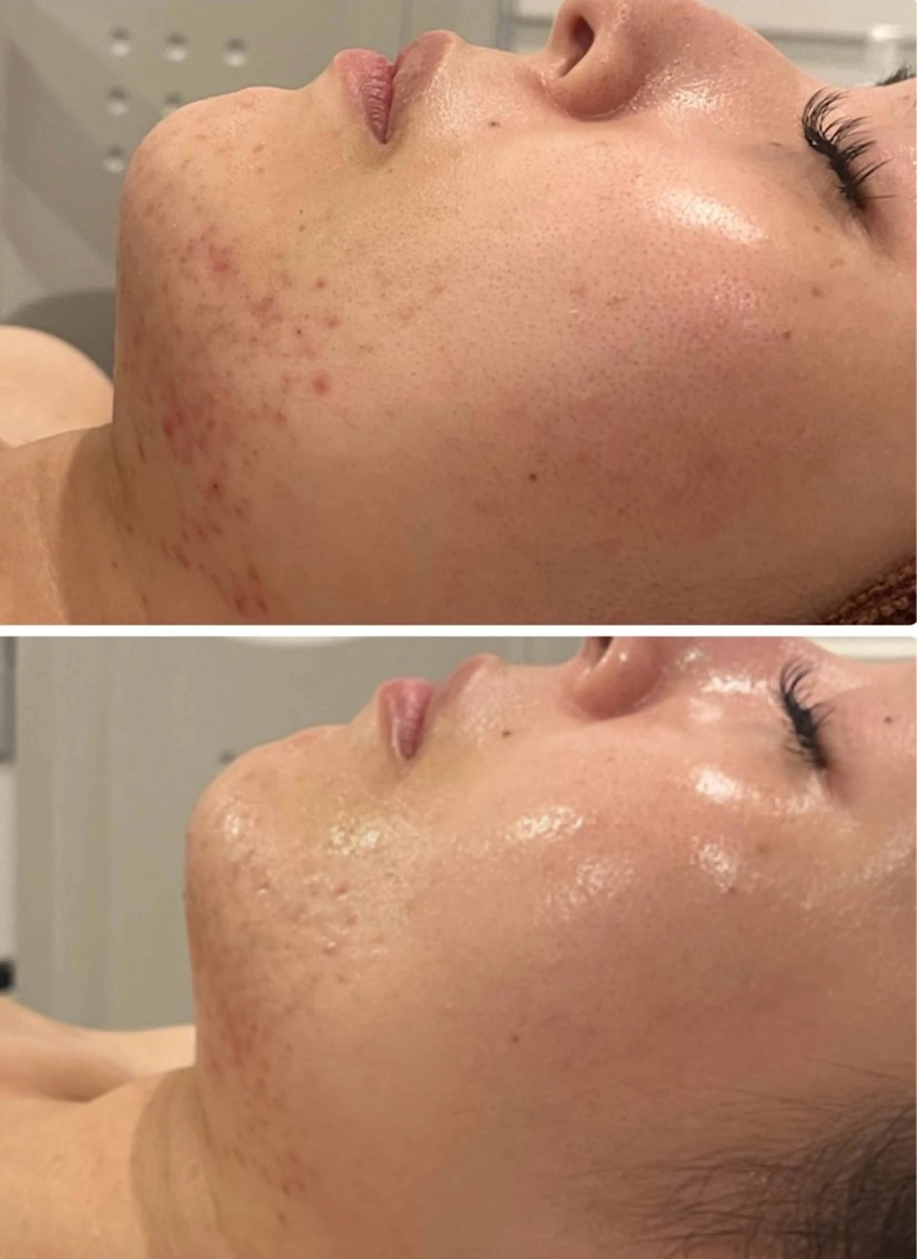 ハイパーナイフEX 小顔×痩身ケアのエステ・リラクイメージ