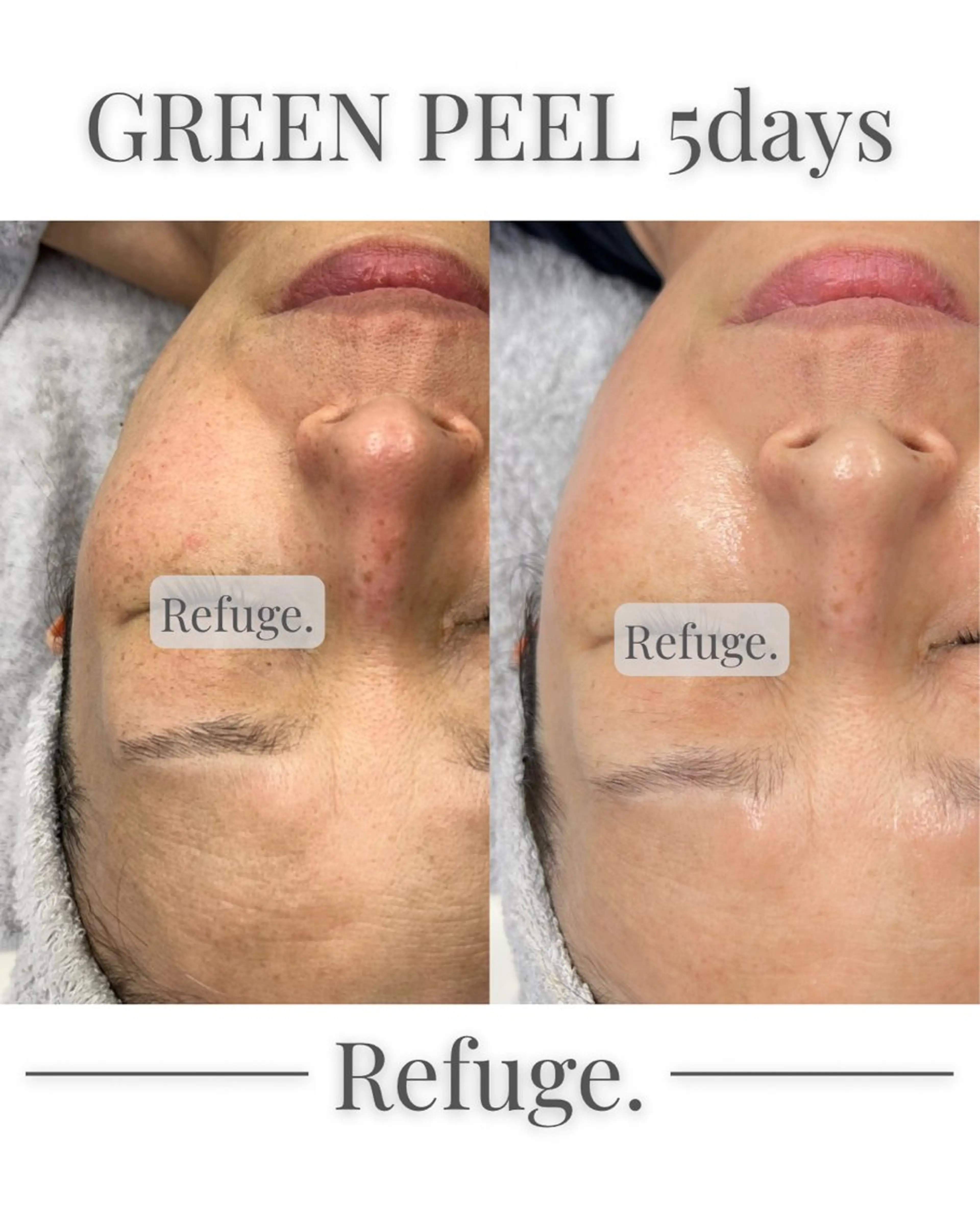 グリーンピール専門サロン Refuge.所属・Refuge. （リフュージュ）のエステ・リラクイメージ