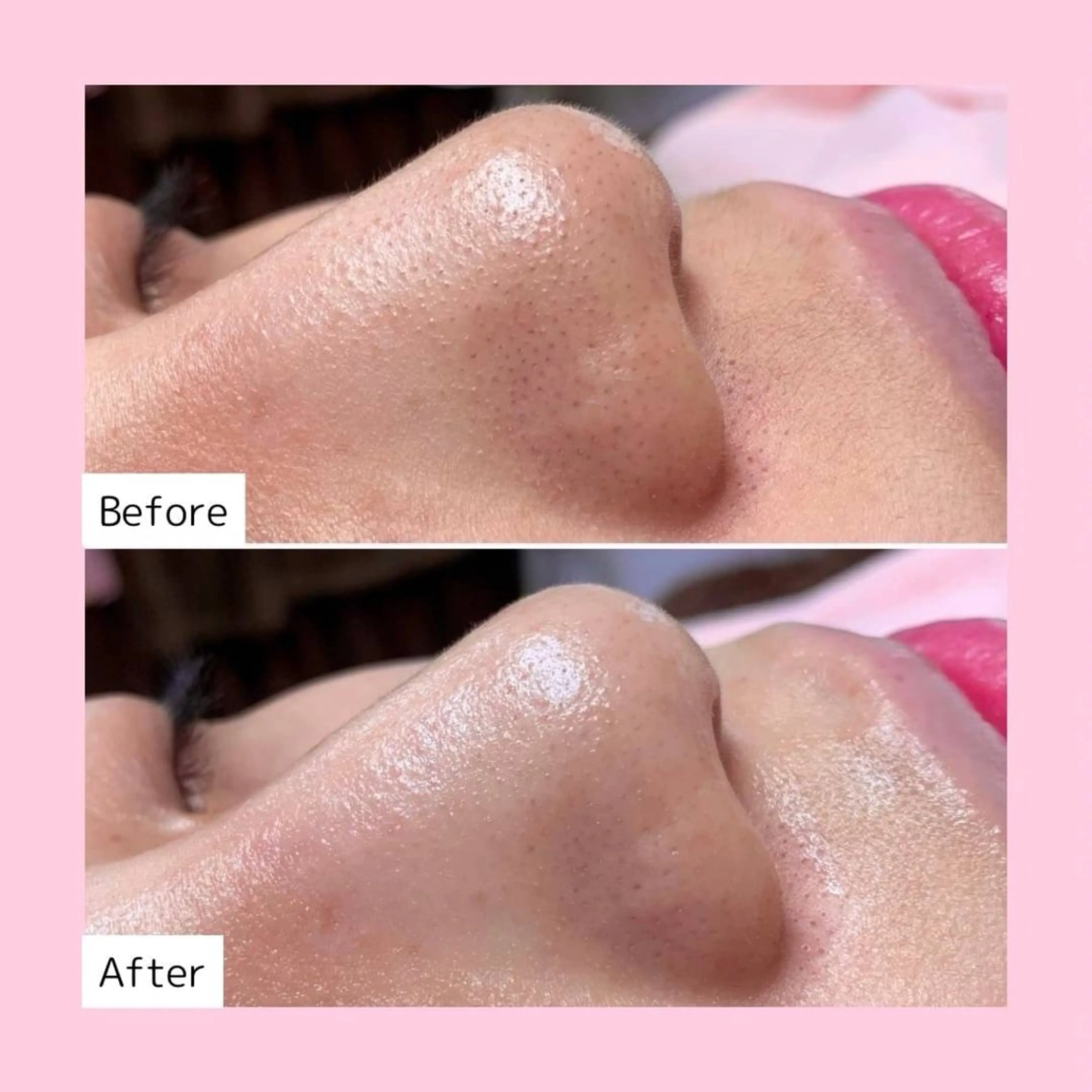 エステ 韓国肌管理専門店　White labo 宝塚店所属・有川 凜のエステ・リラクイメージ