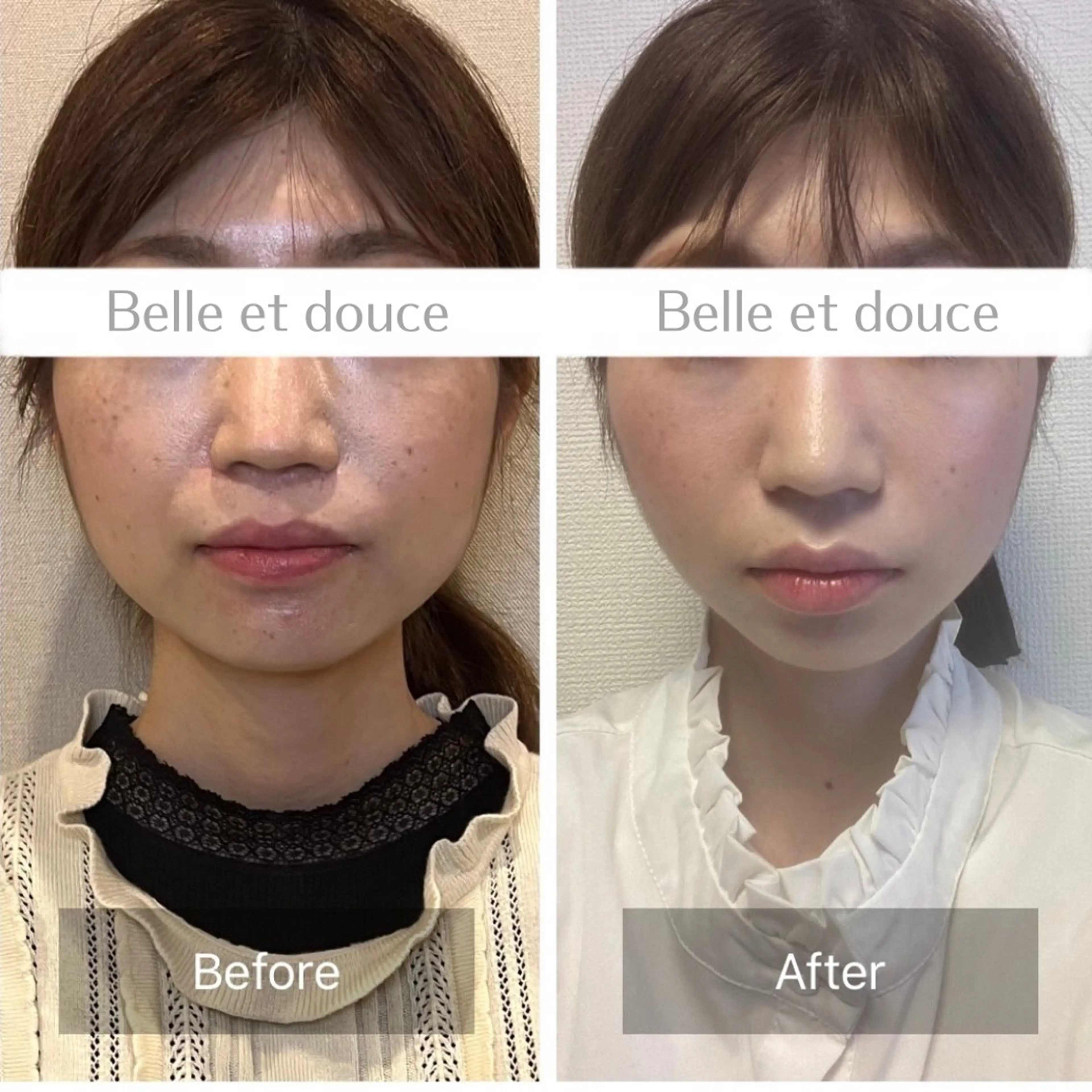 エステ Belle et douce所属・毛穴ケア専門サロン ベルエドゥースのエステ・リラクイメージ