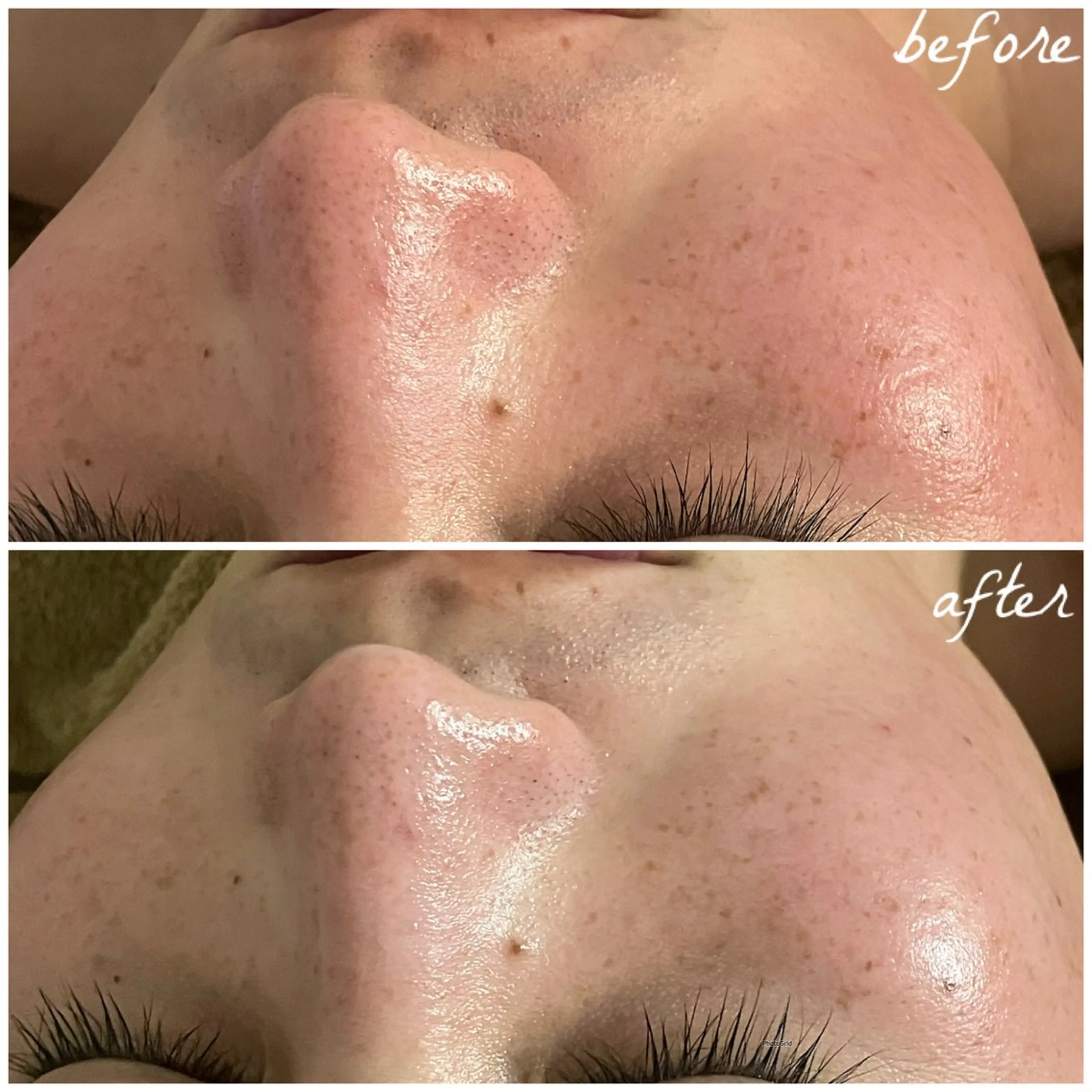 メンズ エステ メナード岐阜茜部 杉浦のエステ・リラクイメージ