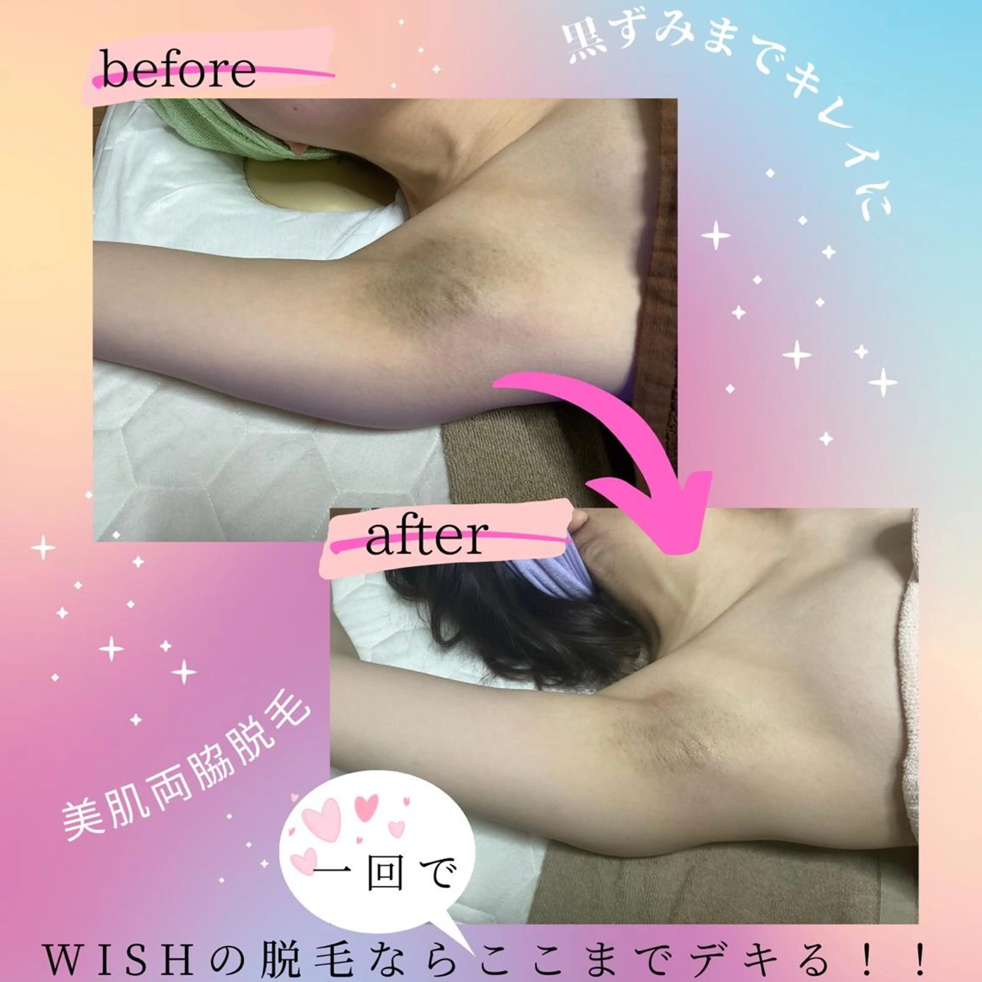 WISH 美肌脱毛のプロ！須藤のエステ・リラクイメージ