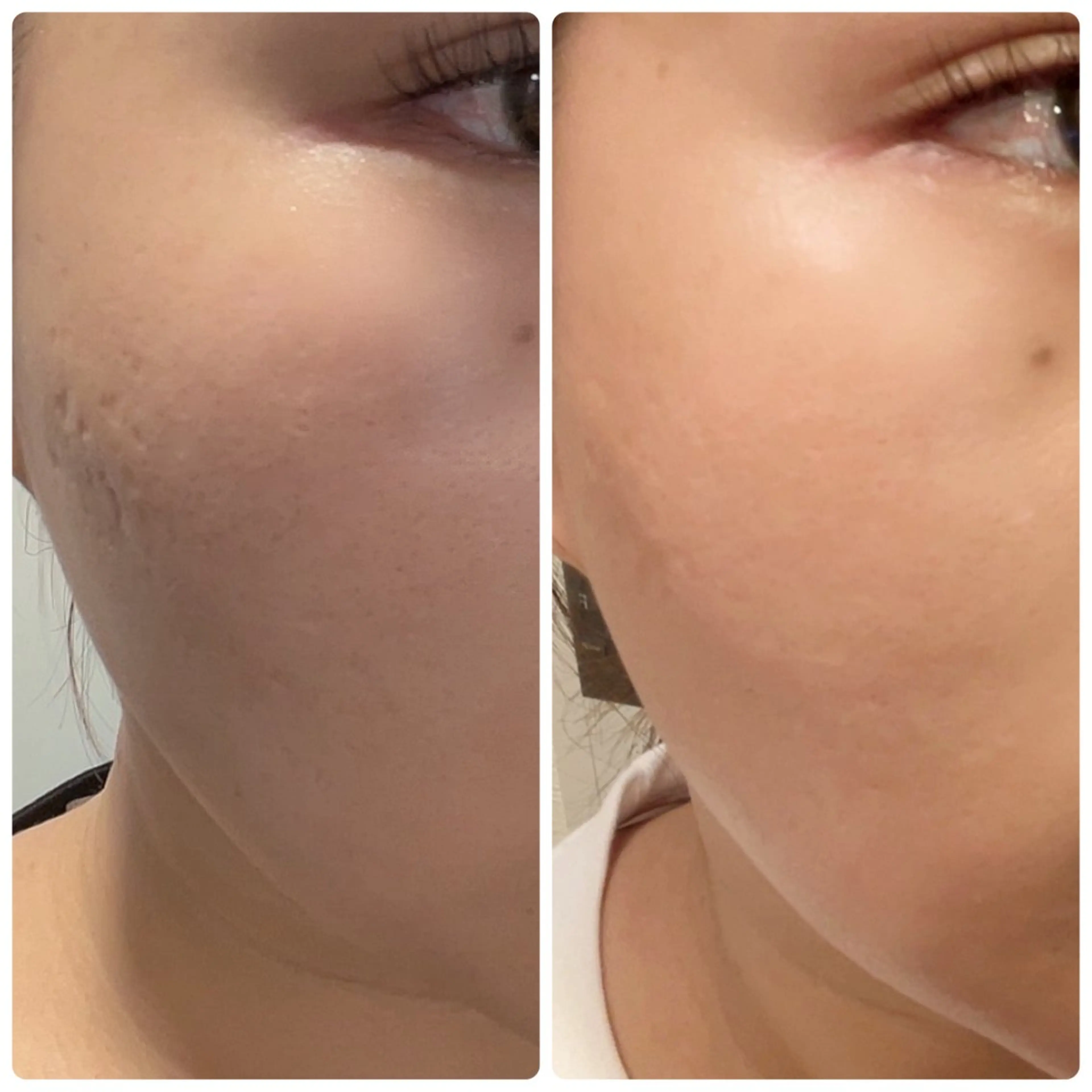 ナリスビューティーサロン池袋店所属・スズキ マイのエステ・リラクイメージ