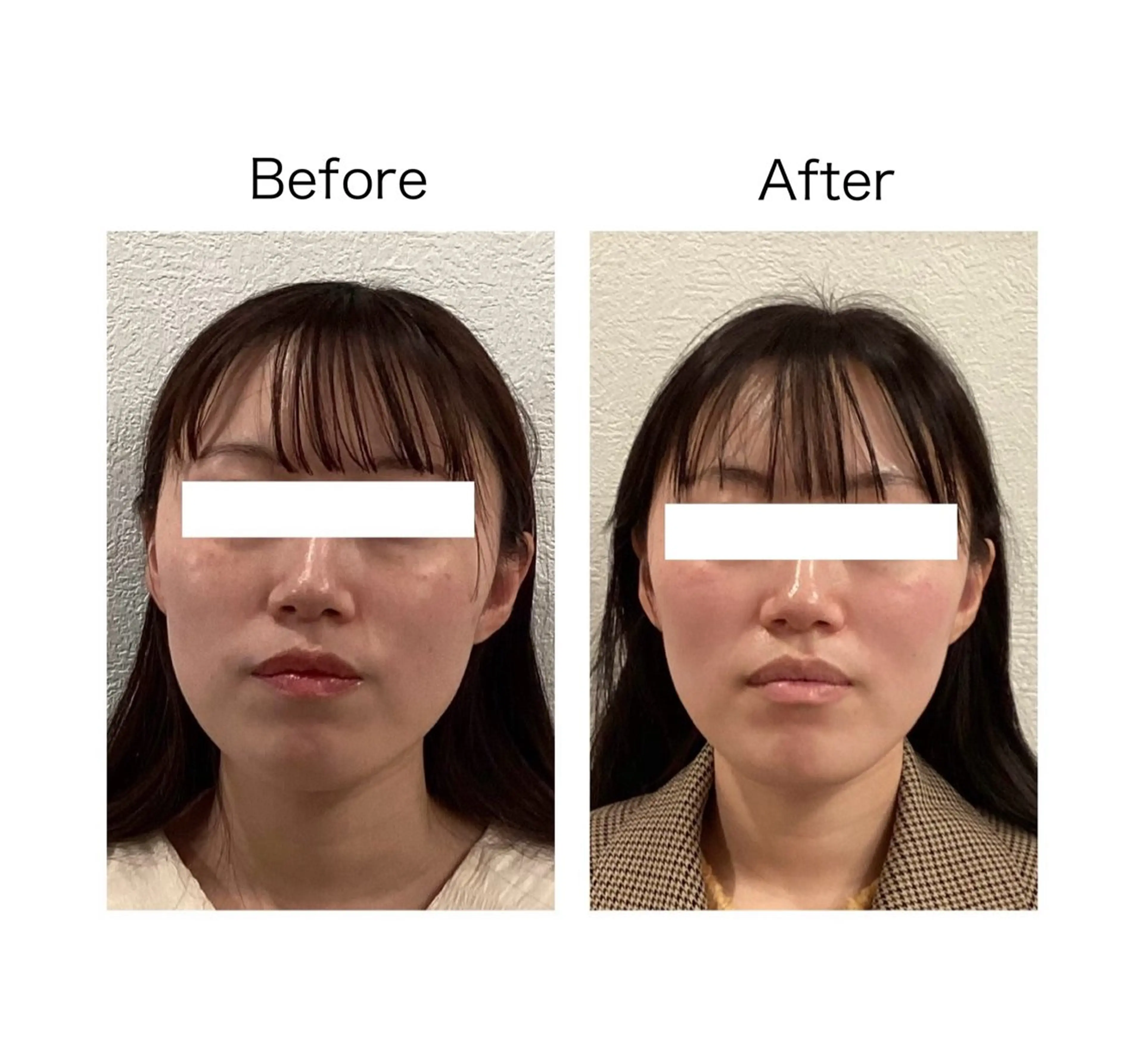 小顔サロンSharp …腸調整よもぎ蒸しのエステ・リラクイメージ