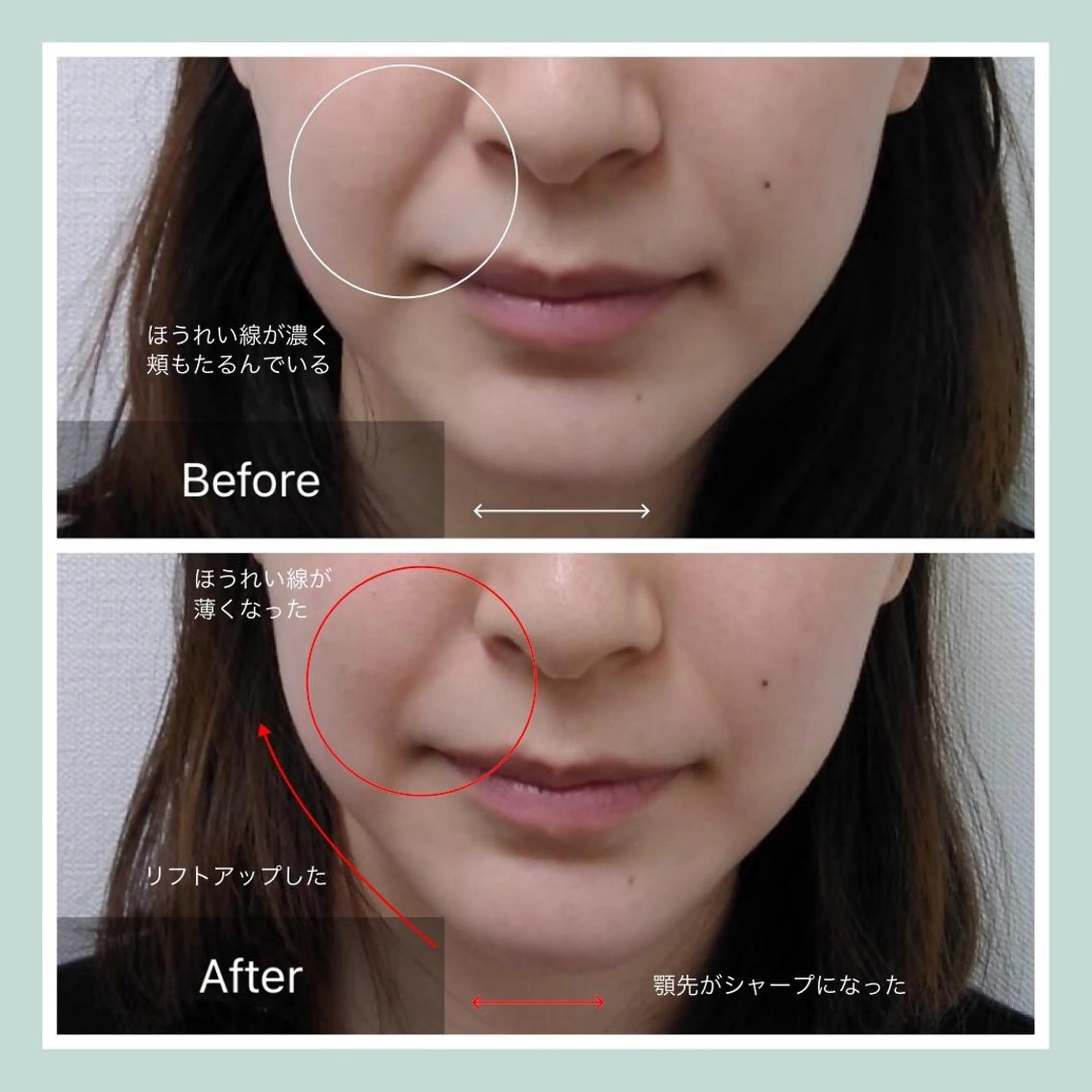 韓国/ヌーディー系 ネイル自由が丘のネイルデザイン