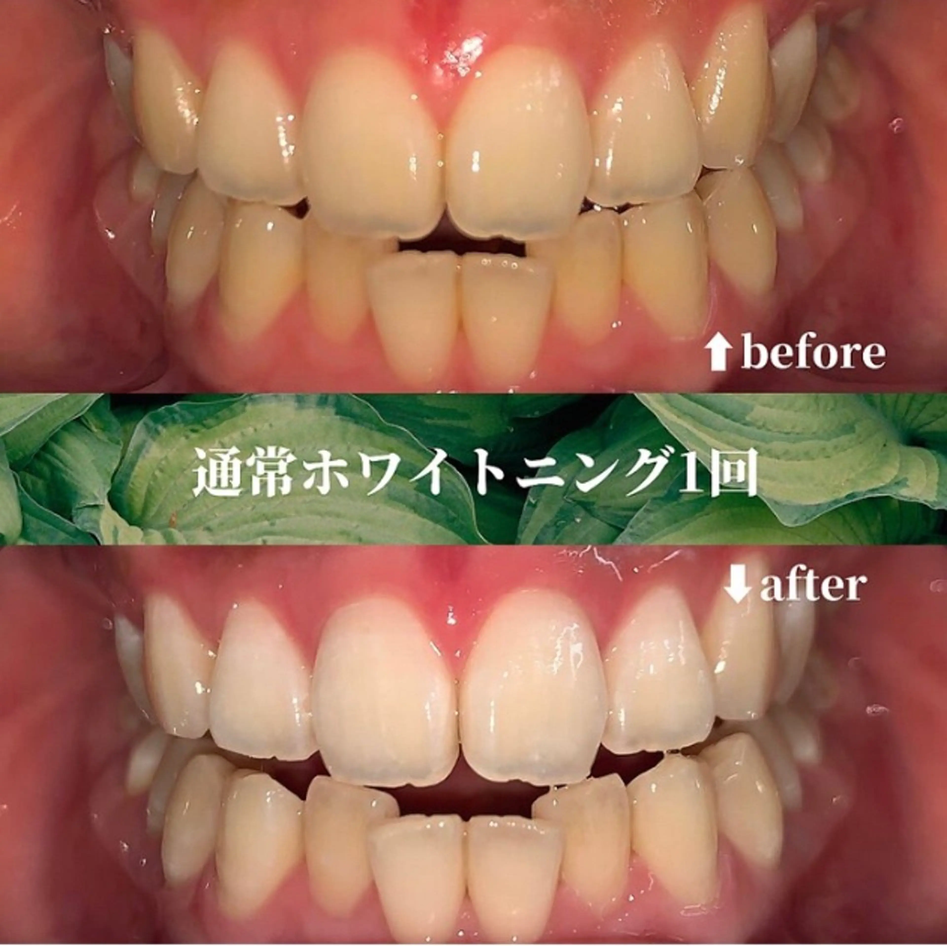 futaba ホワイトニング/天神のエステ・リラクイメージ