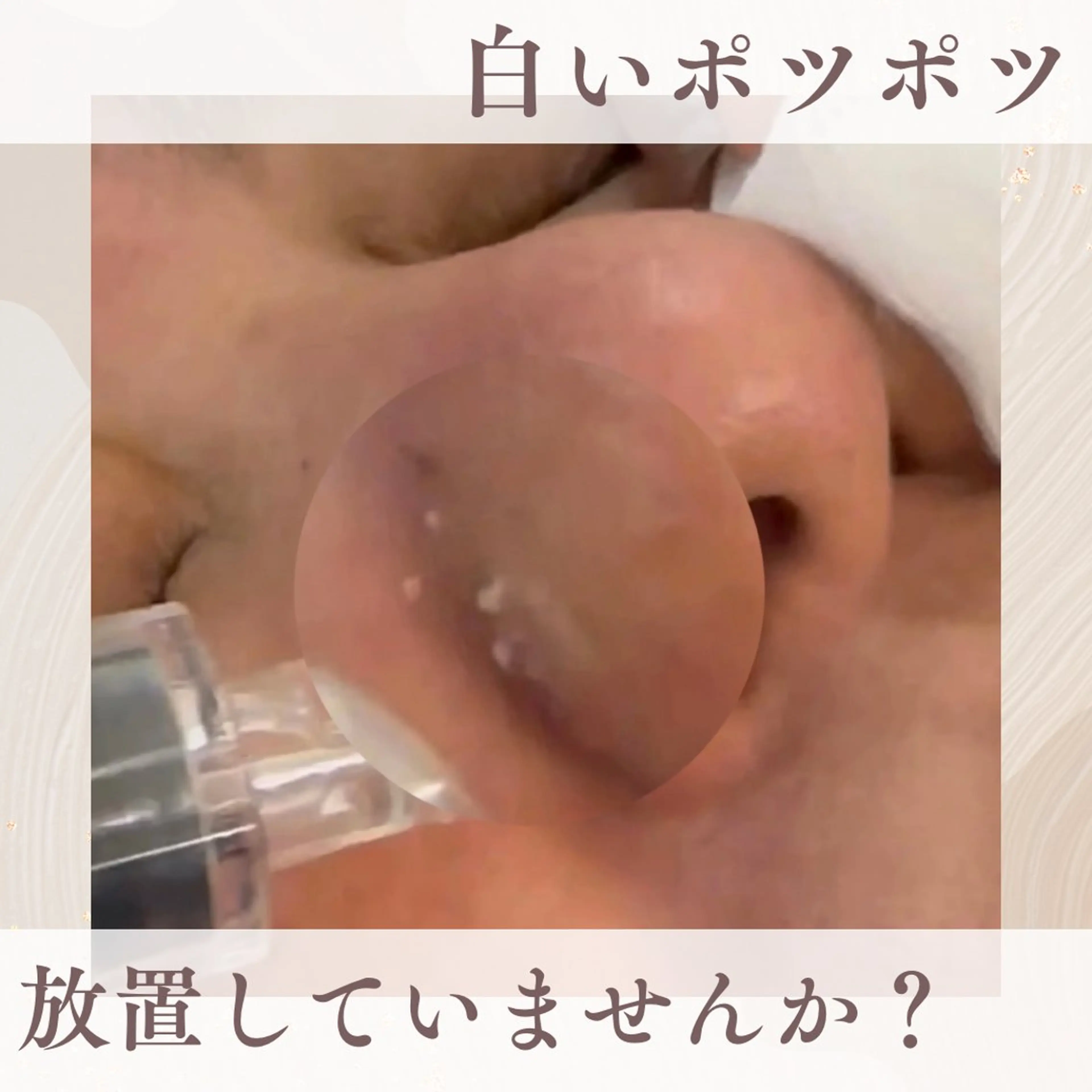 Belle beauty salon所属・Bellebeau tysalonのエステ・リラクイメージ