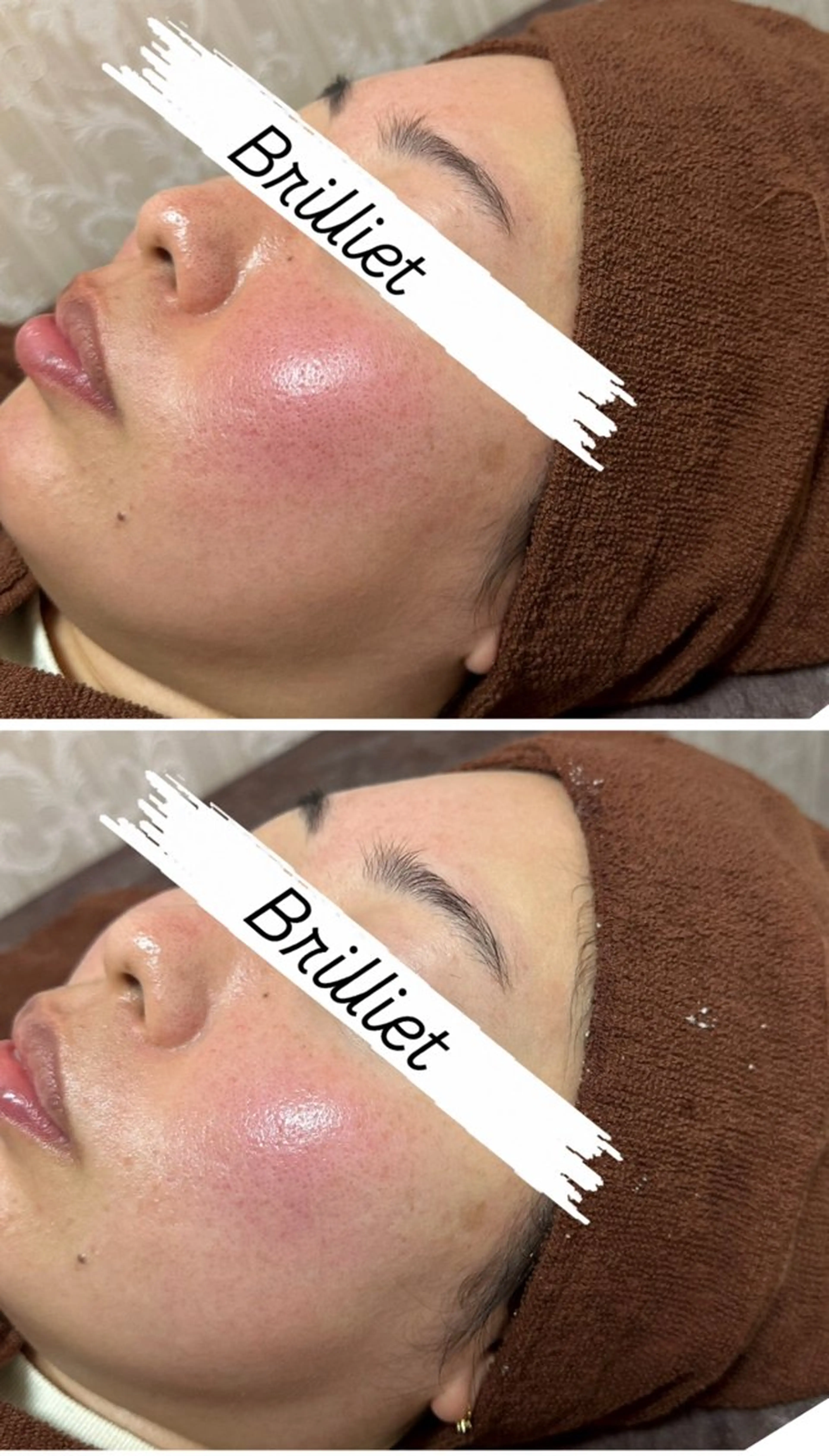 エステ 桐山 まどかのその他イメージ