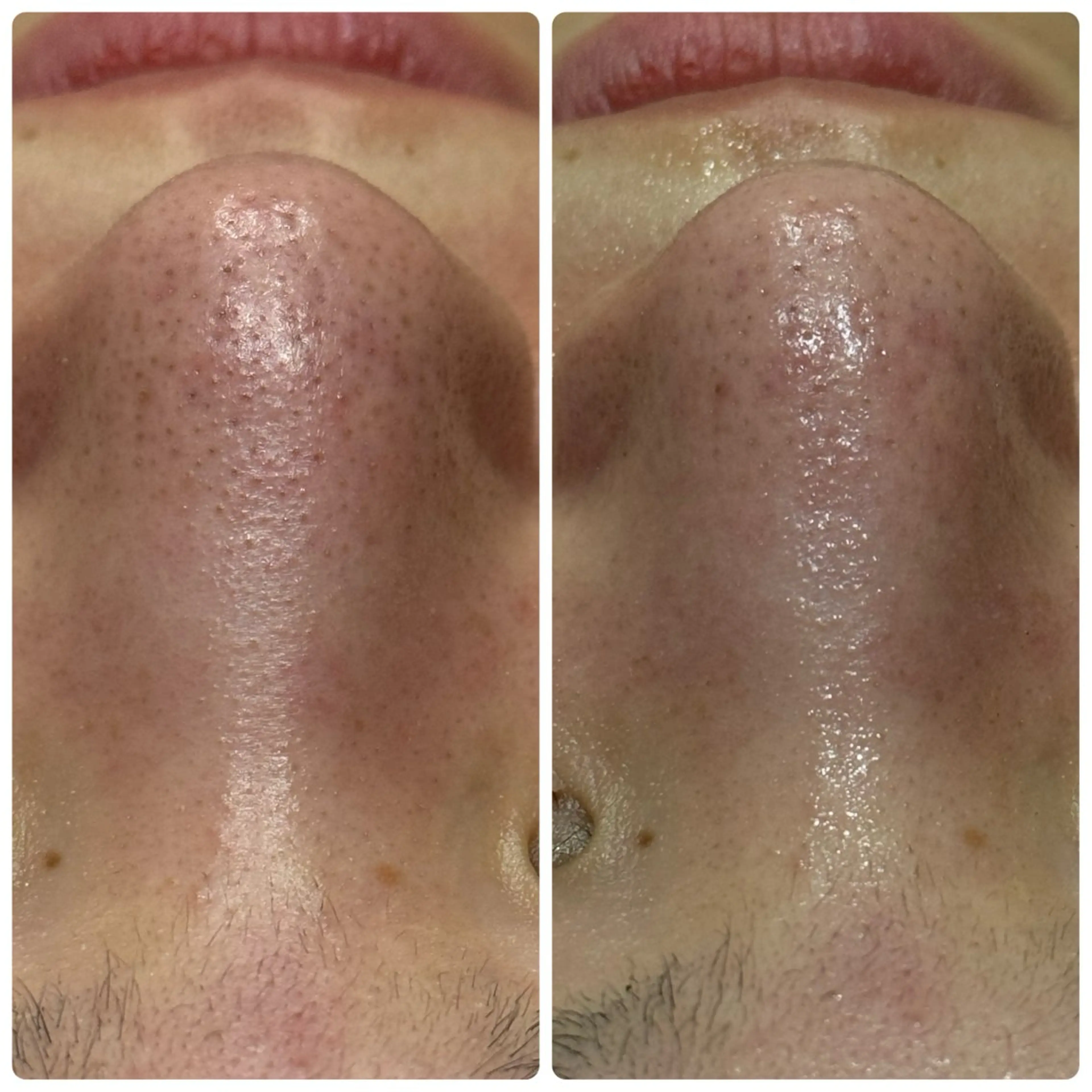 脱毛&フェイシャル 専門店muro.のエステ・リラクイメージ