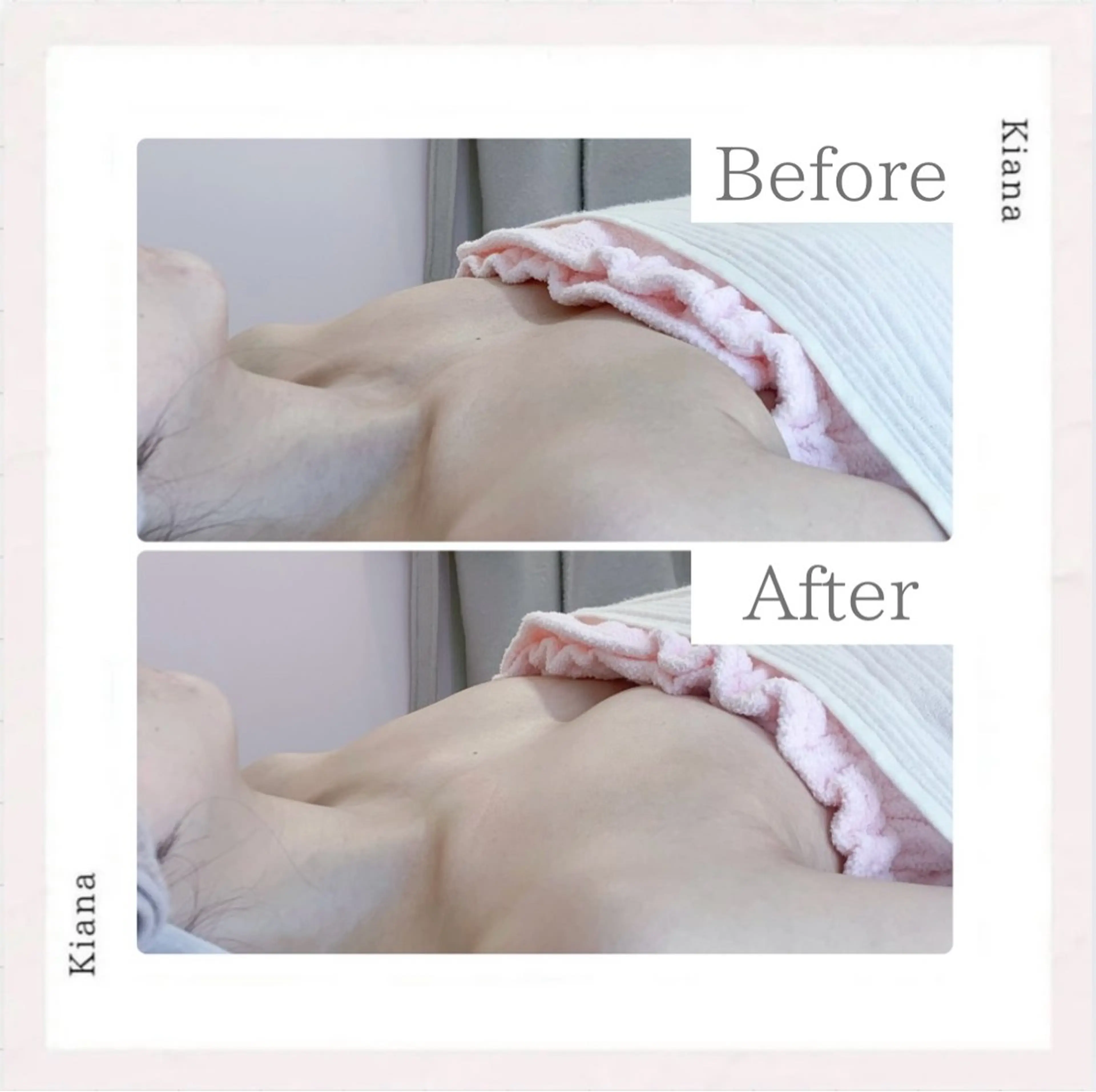 エステ リラク バスト専門Kiana 風のエステ・リラクイメージ