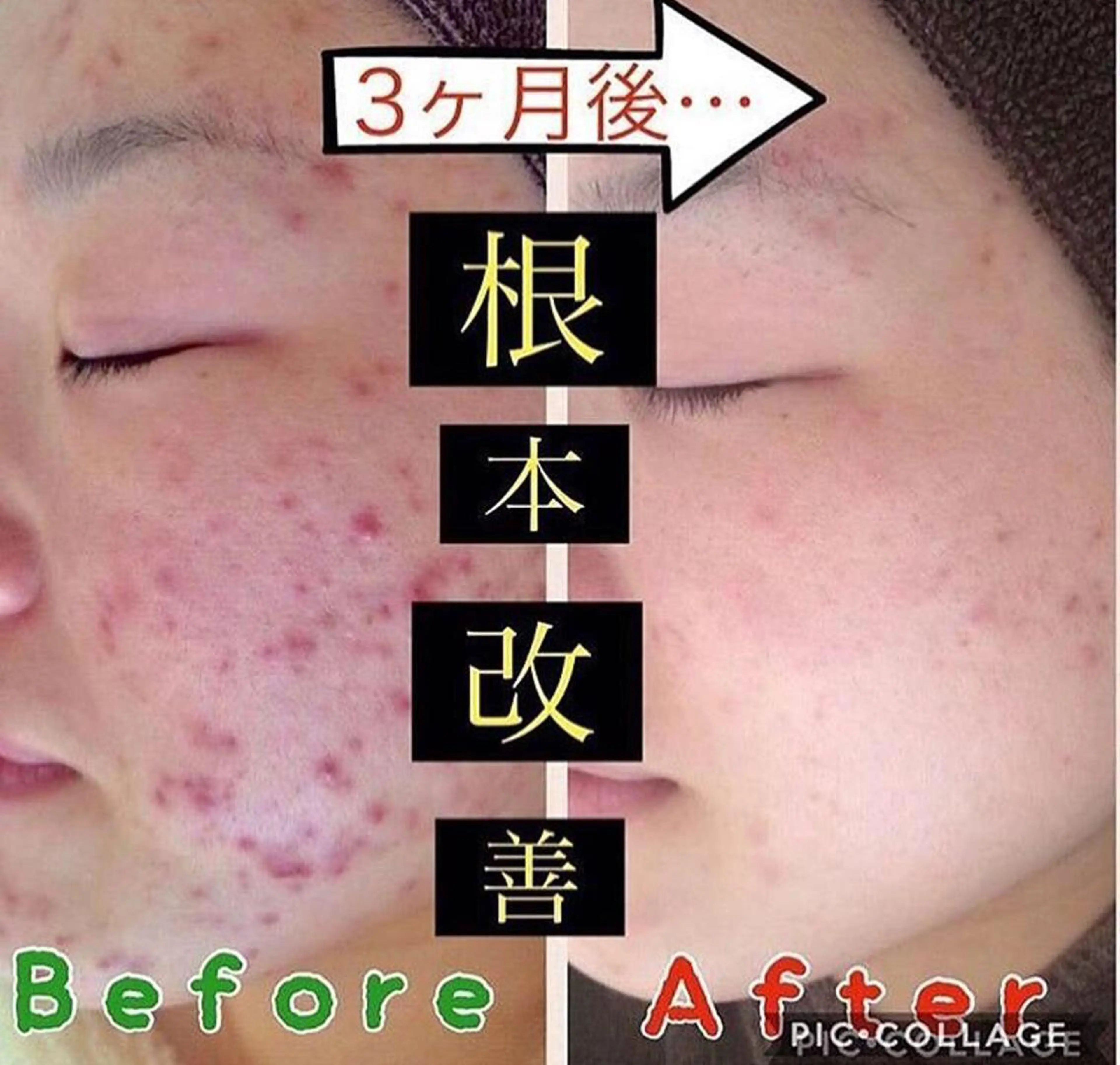 セミロング カラー パーマ ヘアアレンジ メンズ キッズ ネイル マツエク・マツパ ニキビ・肌質改善専門 ♡人生が変わるサロンのエステ・リラクイメージ