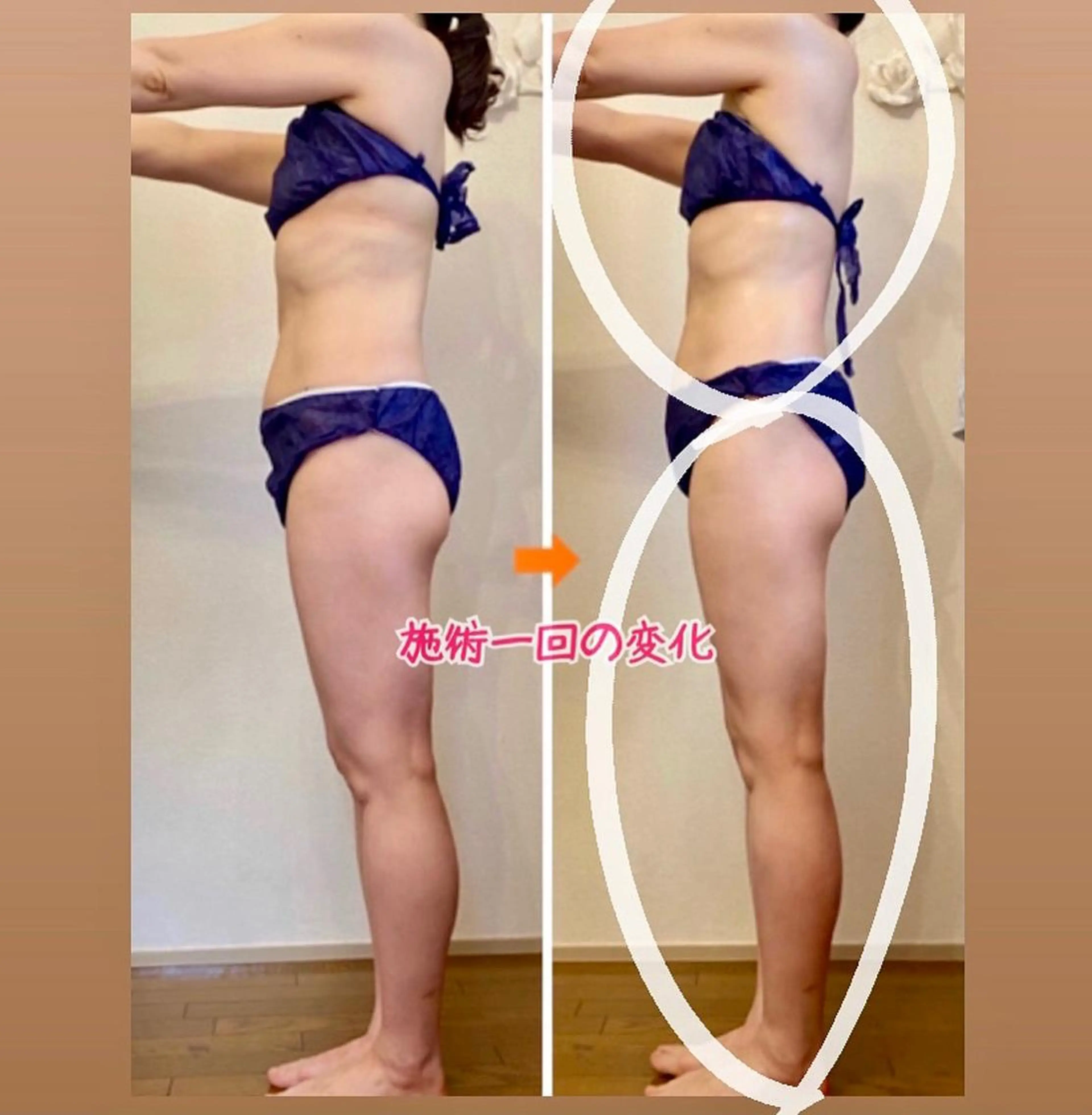 ショート カラー パーマ ヘアアレンジ メンズ キッズ ネイル マツエク・マツパ エステ リラク ‍痩身＆ボディ 結果出し🌟丹野のエステ・リラクイメージ