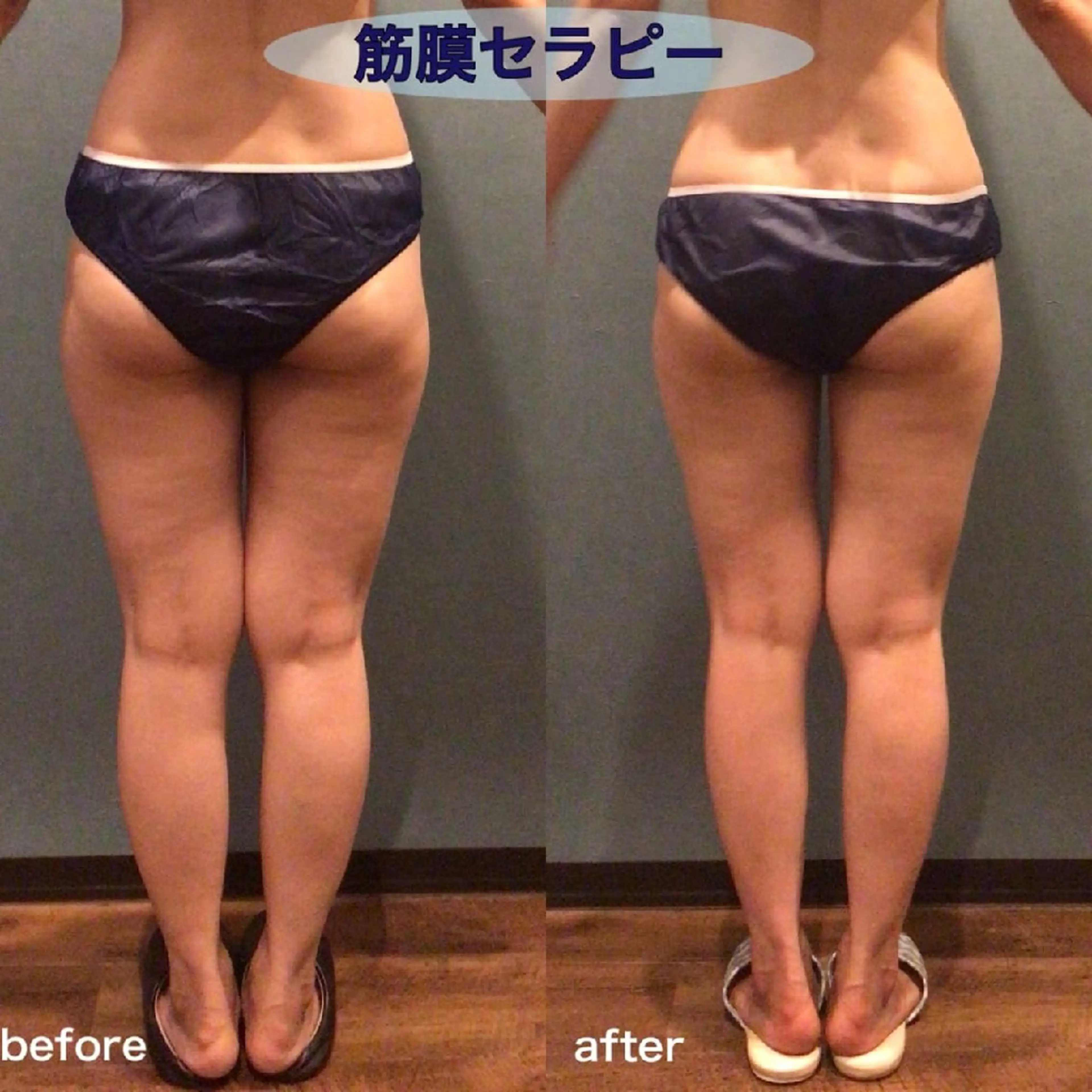 vi roots所属・vi rootsのエステ・リラクイメージ