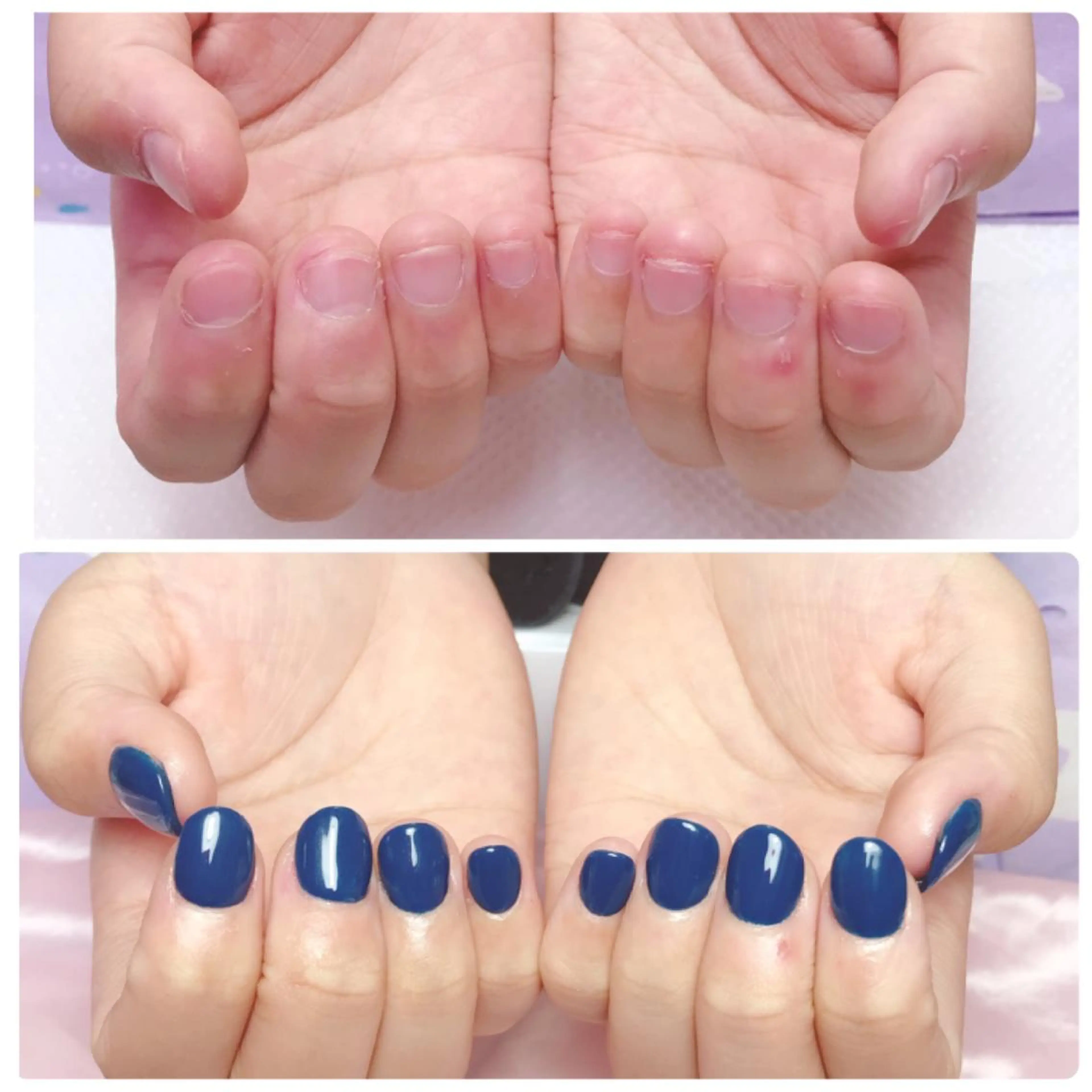 ネイル ハンドネイル 深爪を断らない スカルプ高評価店のネイルデザイン