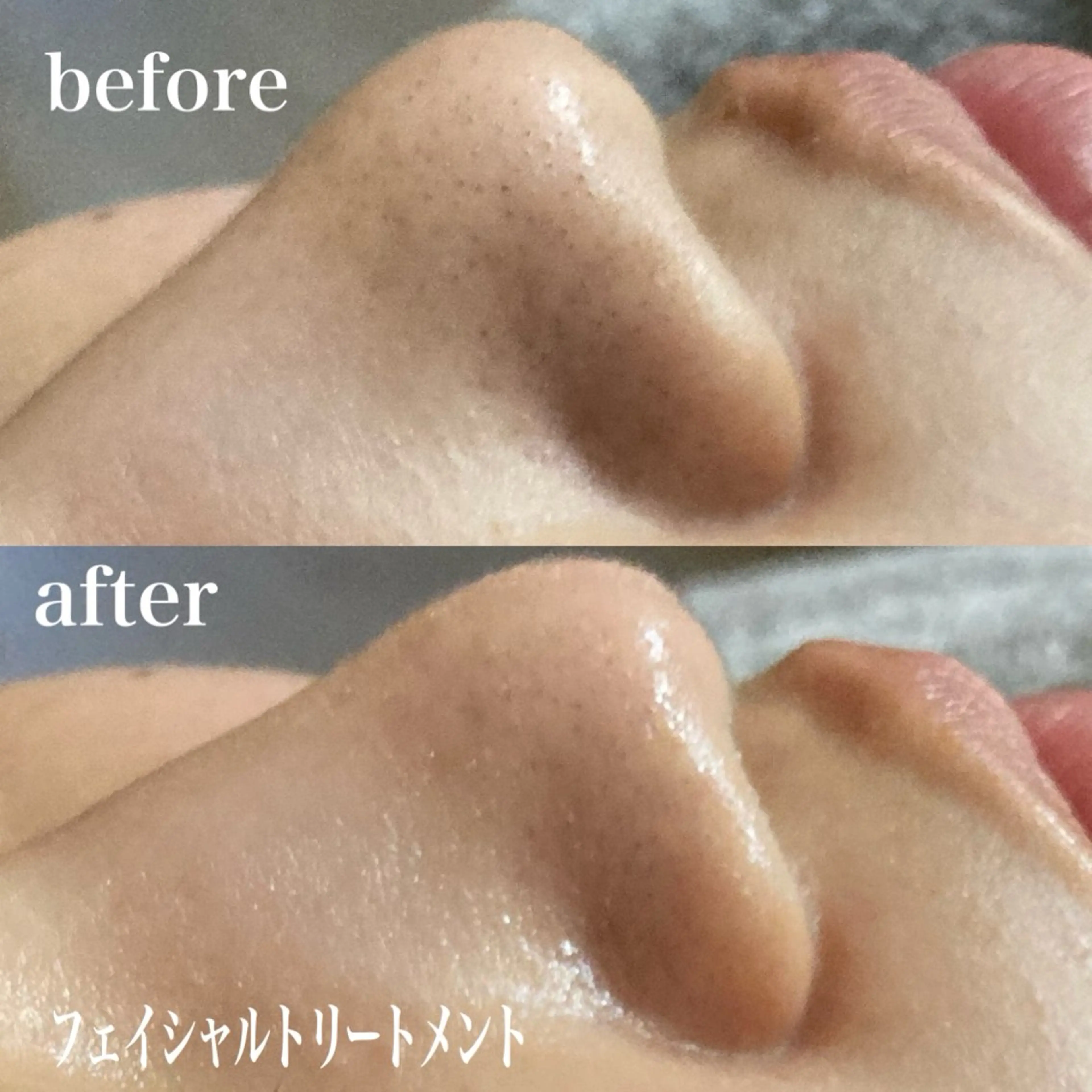 磐田｜LAYLA 一番丁寧な脱毛店のエステ・リラクイメージ