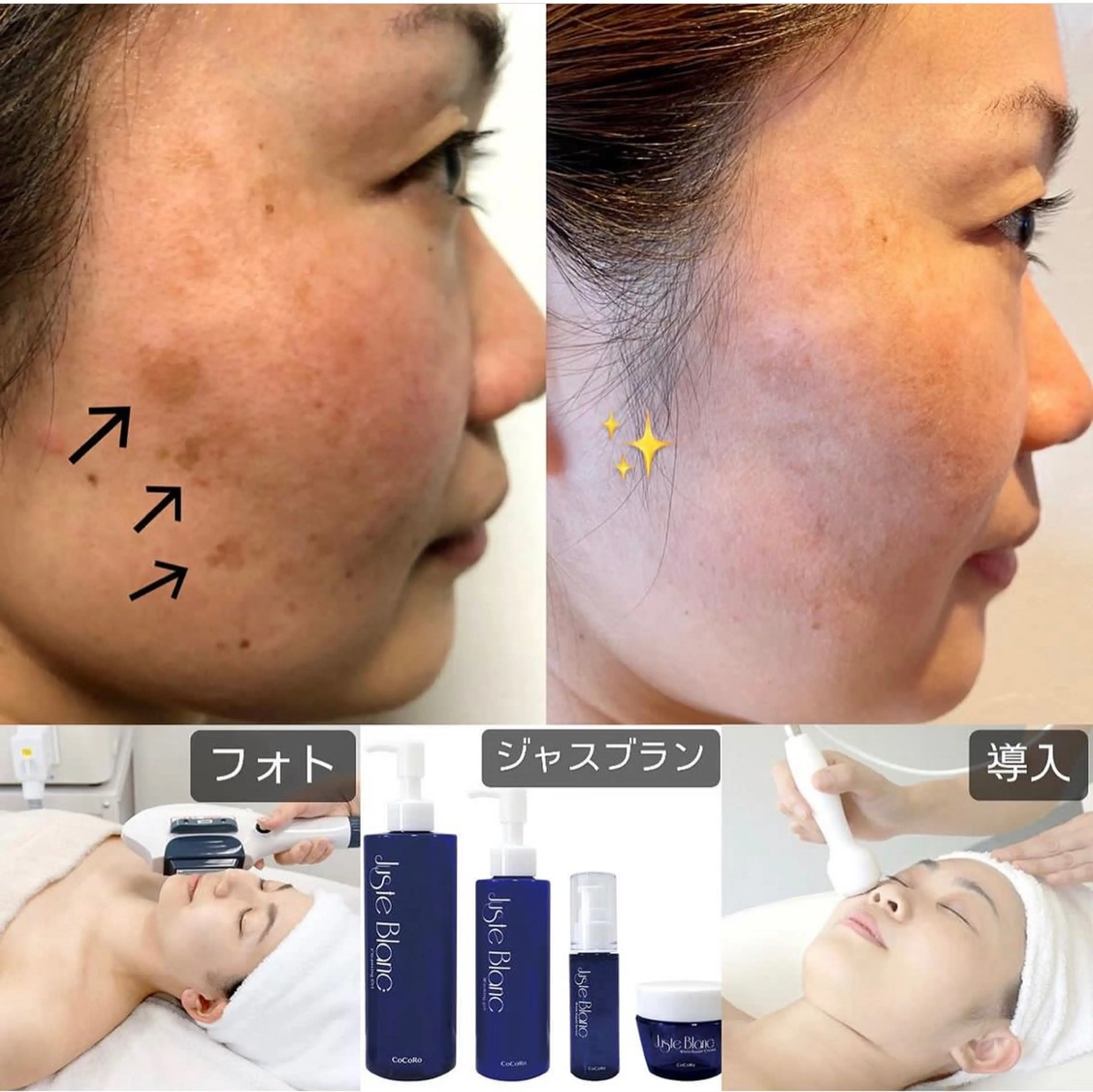 エステ リラク Richeka リシェカのエステ・リラクイメージ