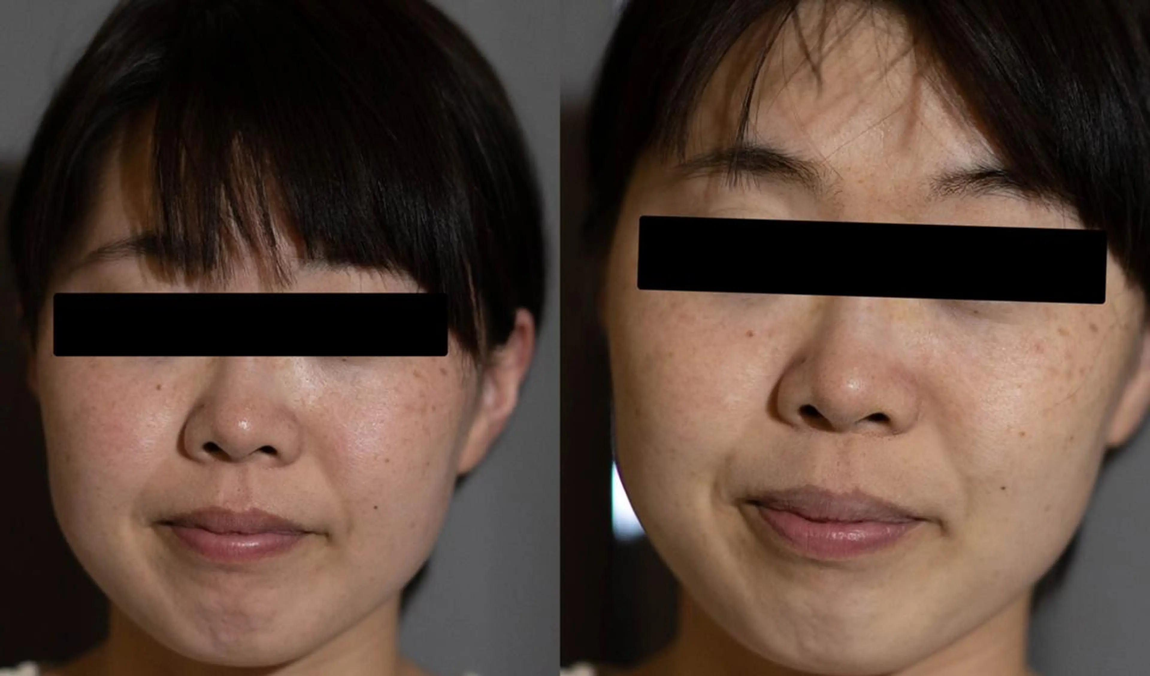 中山 秀展のエステ・リラクイメージ