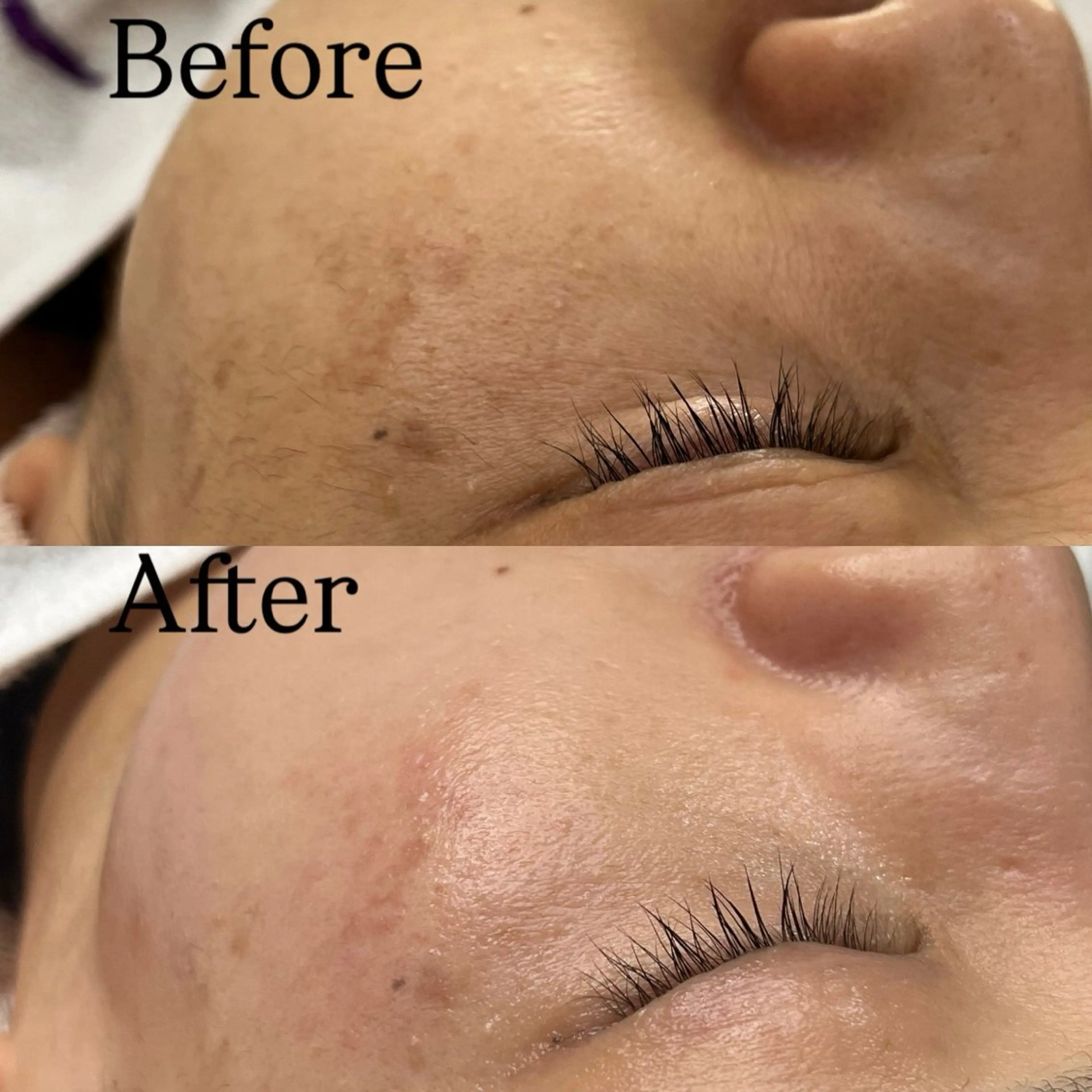 Rejue所属・永田 茜のエステ・リラクイメージ