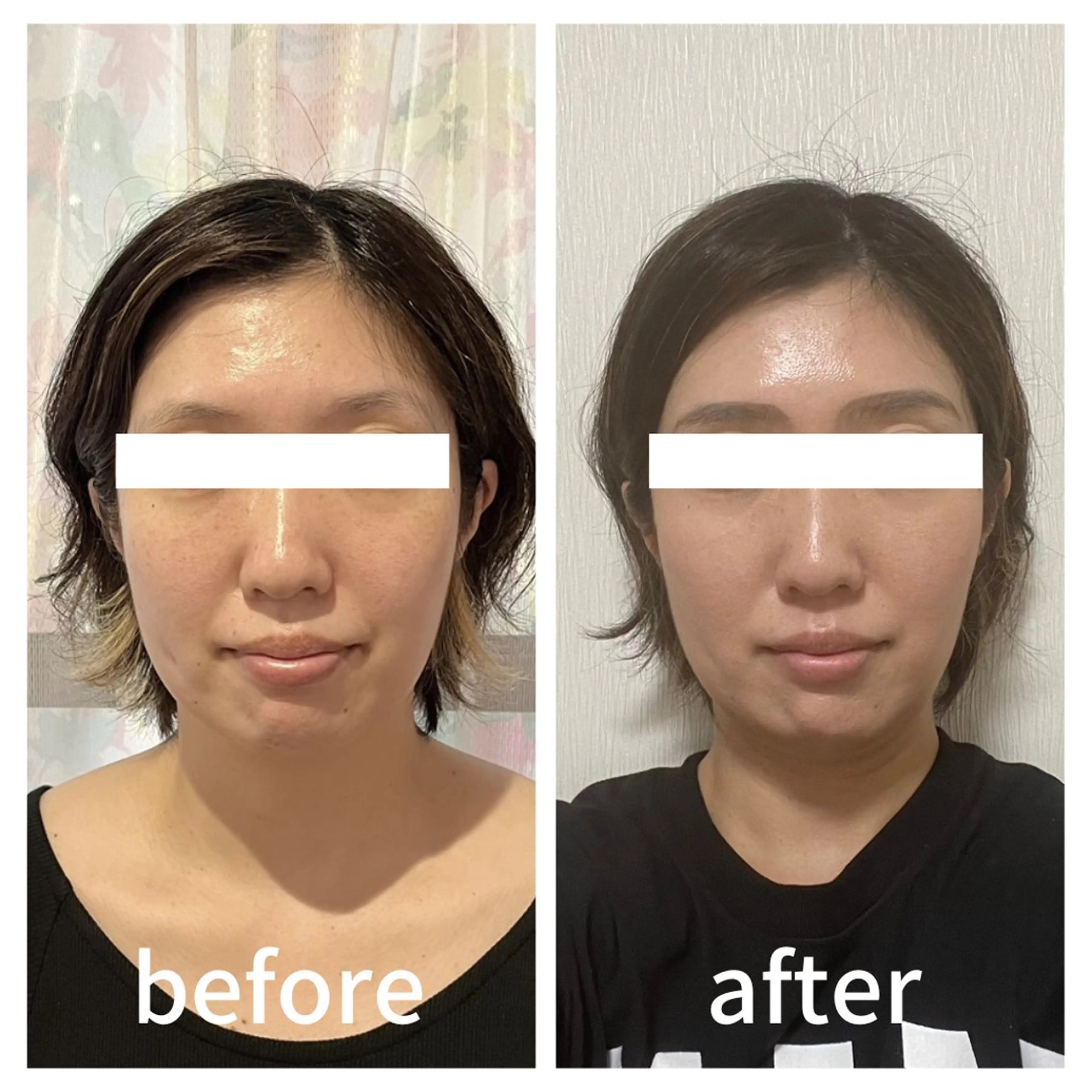 小顔サロン AMYONのエステ・リラクイメージ