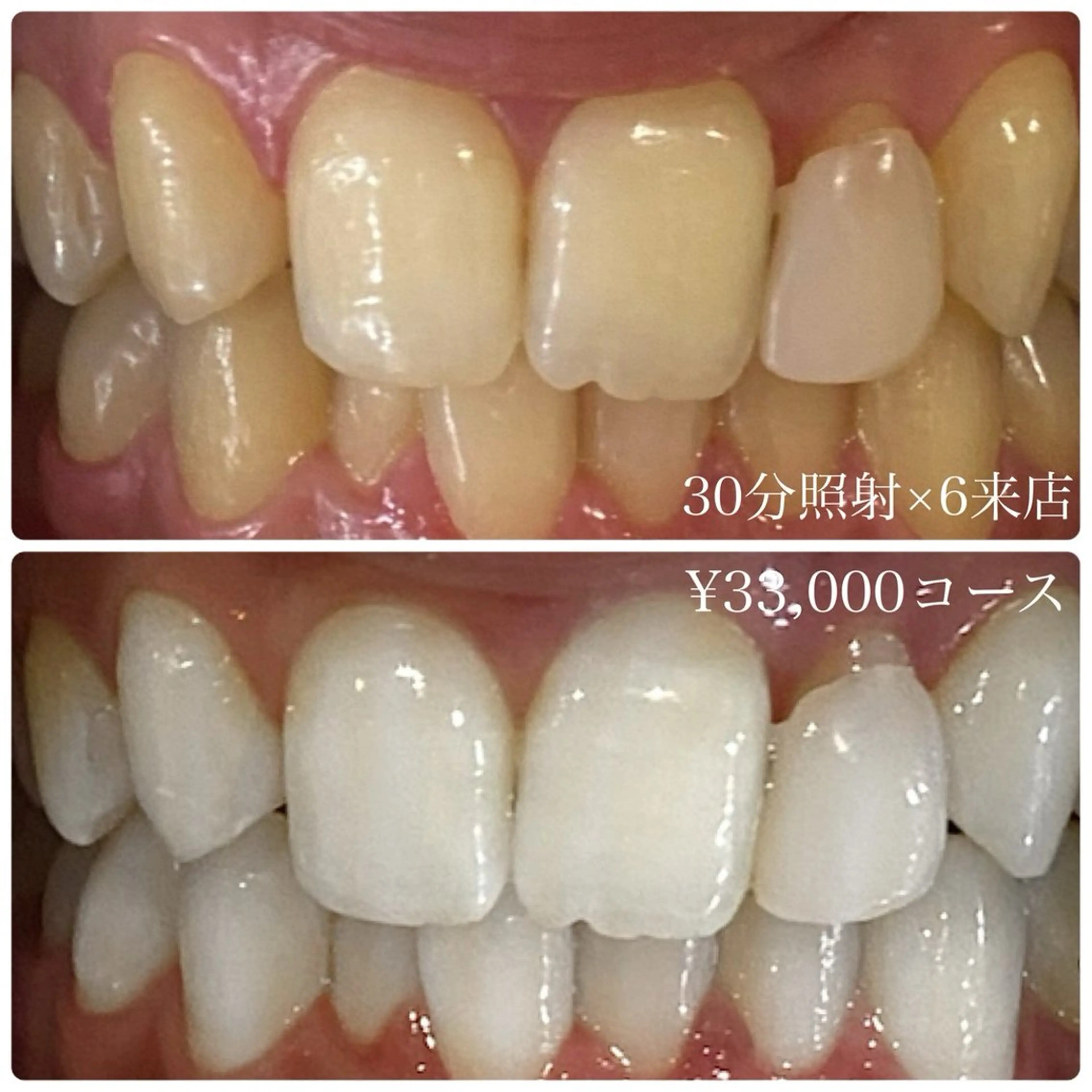 PLATINUM Beauty 横浜店所属・ホワイトニングルーム 横浜店のその他イメージ