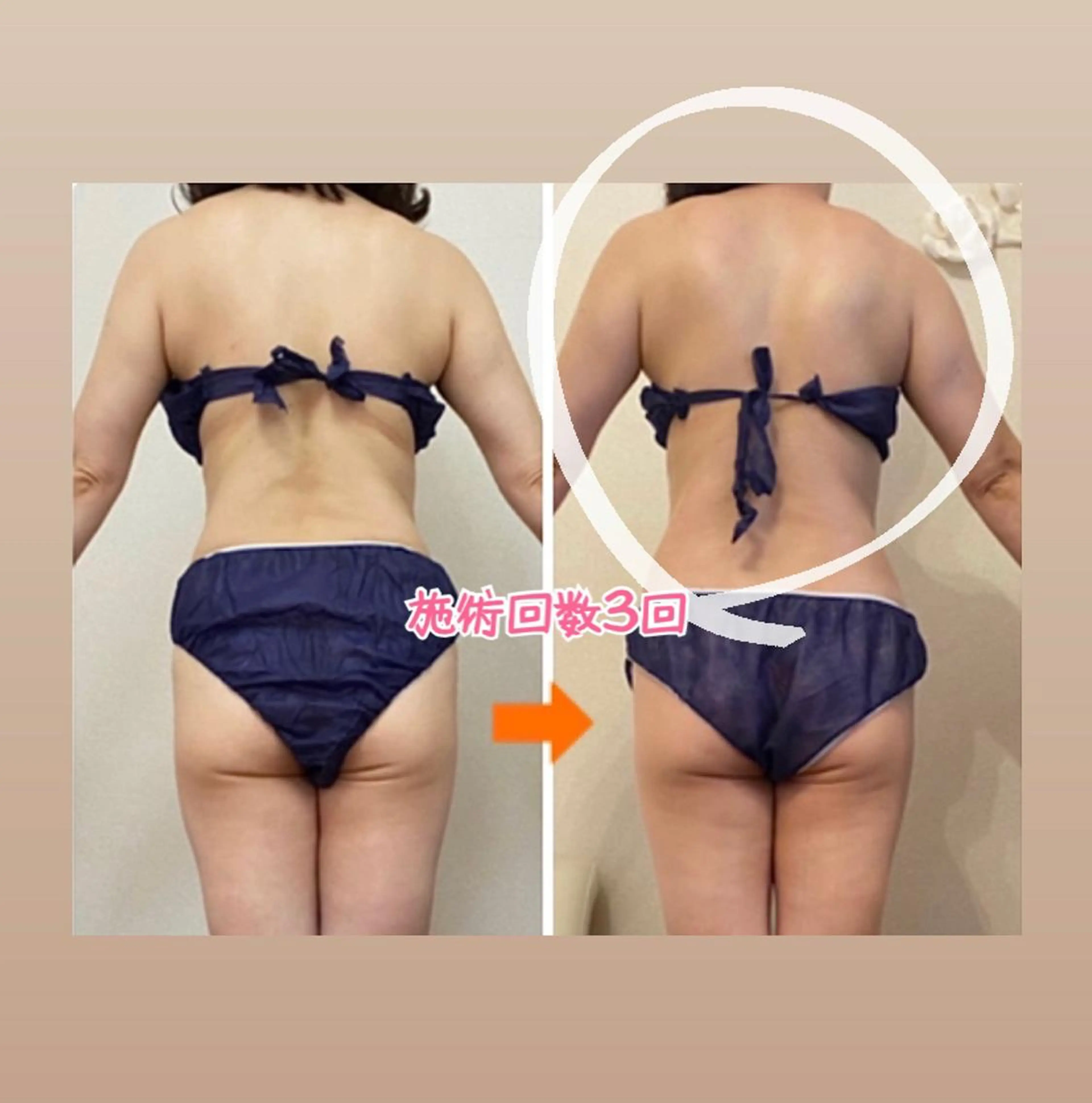 ショート カラー パーマ ヘアアレンジ メンズ キッズ ネイル マツエク・マツパ ‍痩身＆ボディ 結果出し🌟丹野のエステ・リラクイメージ