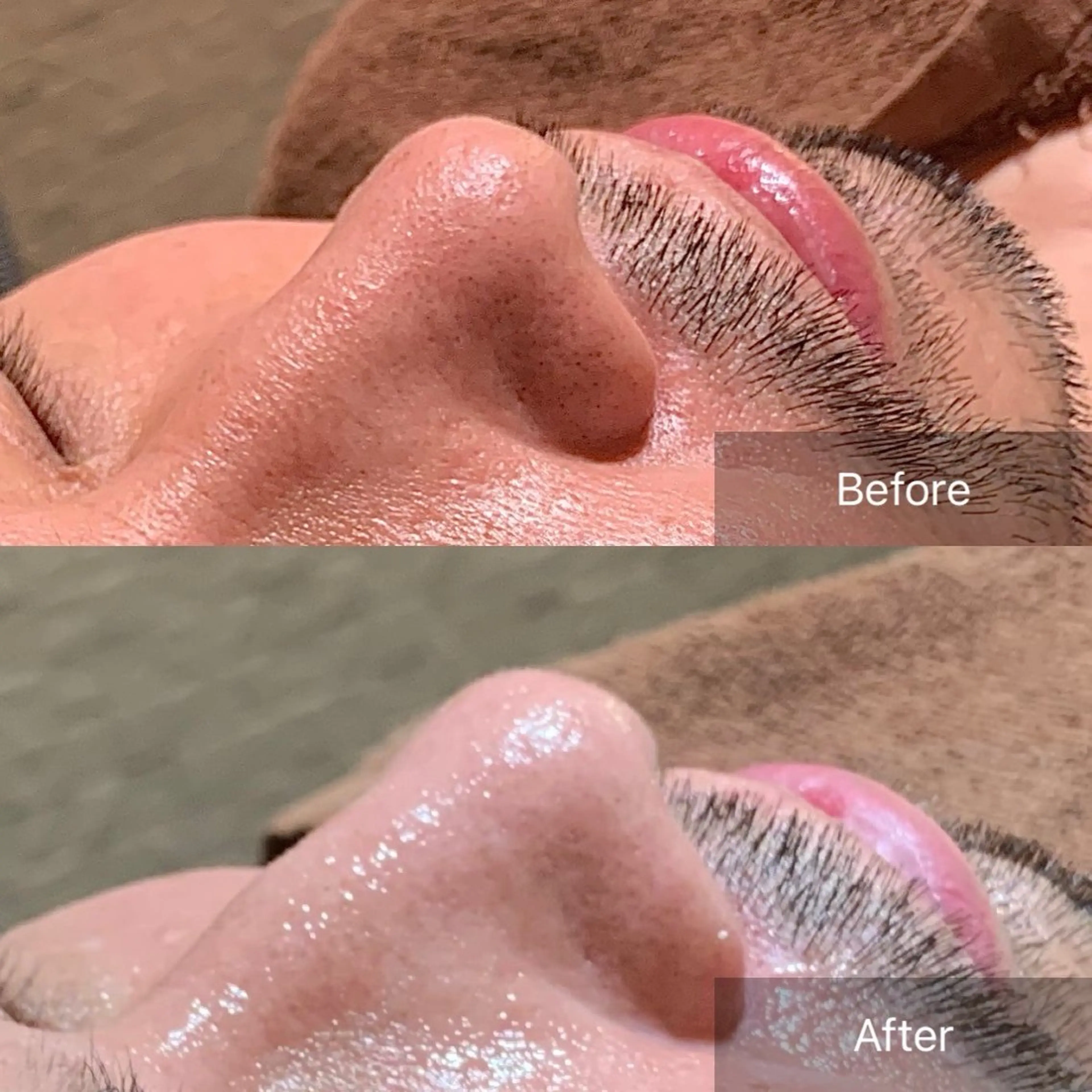 渋谷ベルゼ🌷木下 毛穴/脱毛/フェムのその他イメージ