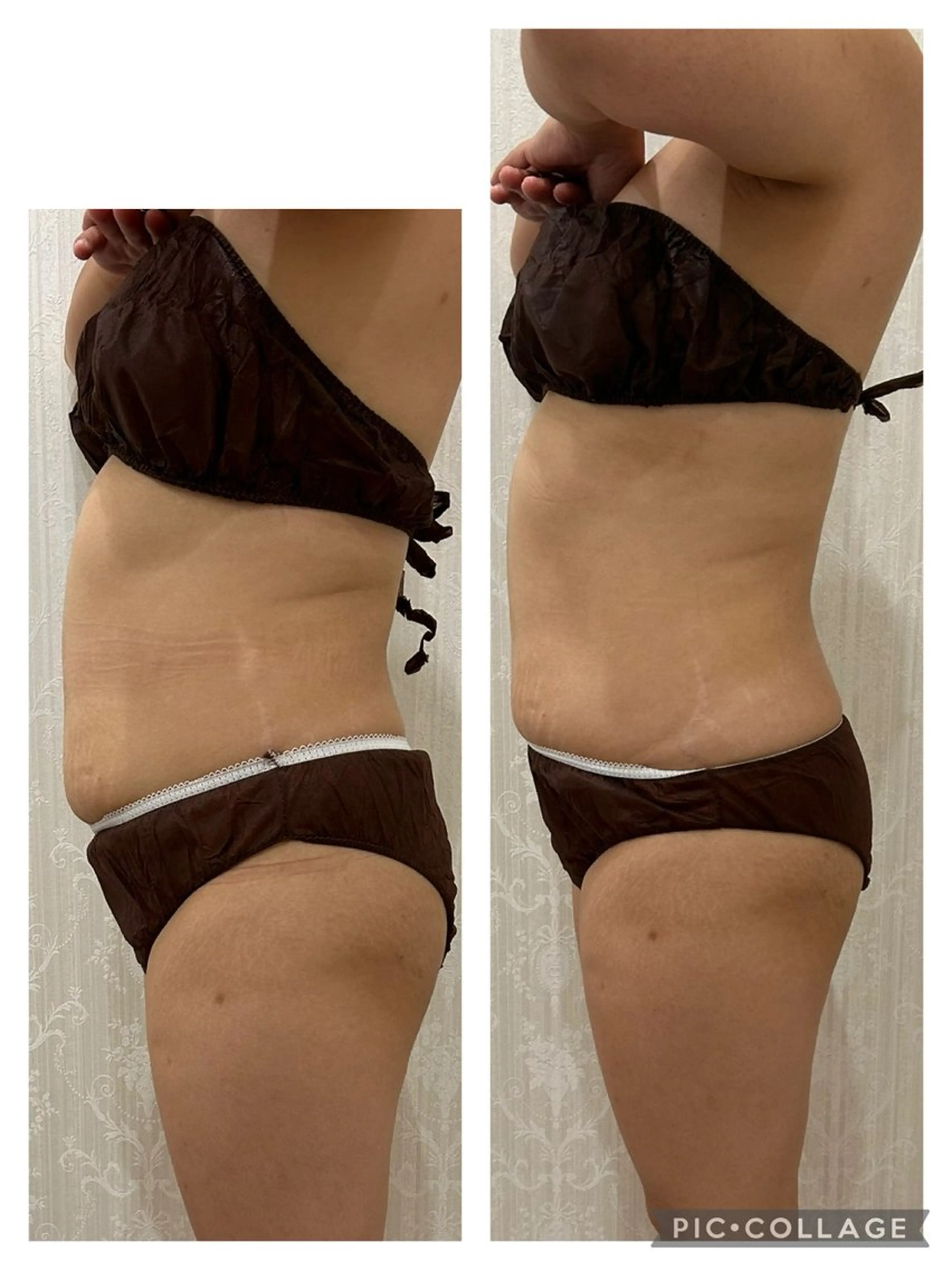 Silky ✖︎ Snow White｜エイジングケア＆美肌脱毛専門サロン所属・O 朋美のエステ・リラクイメージ