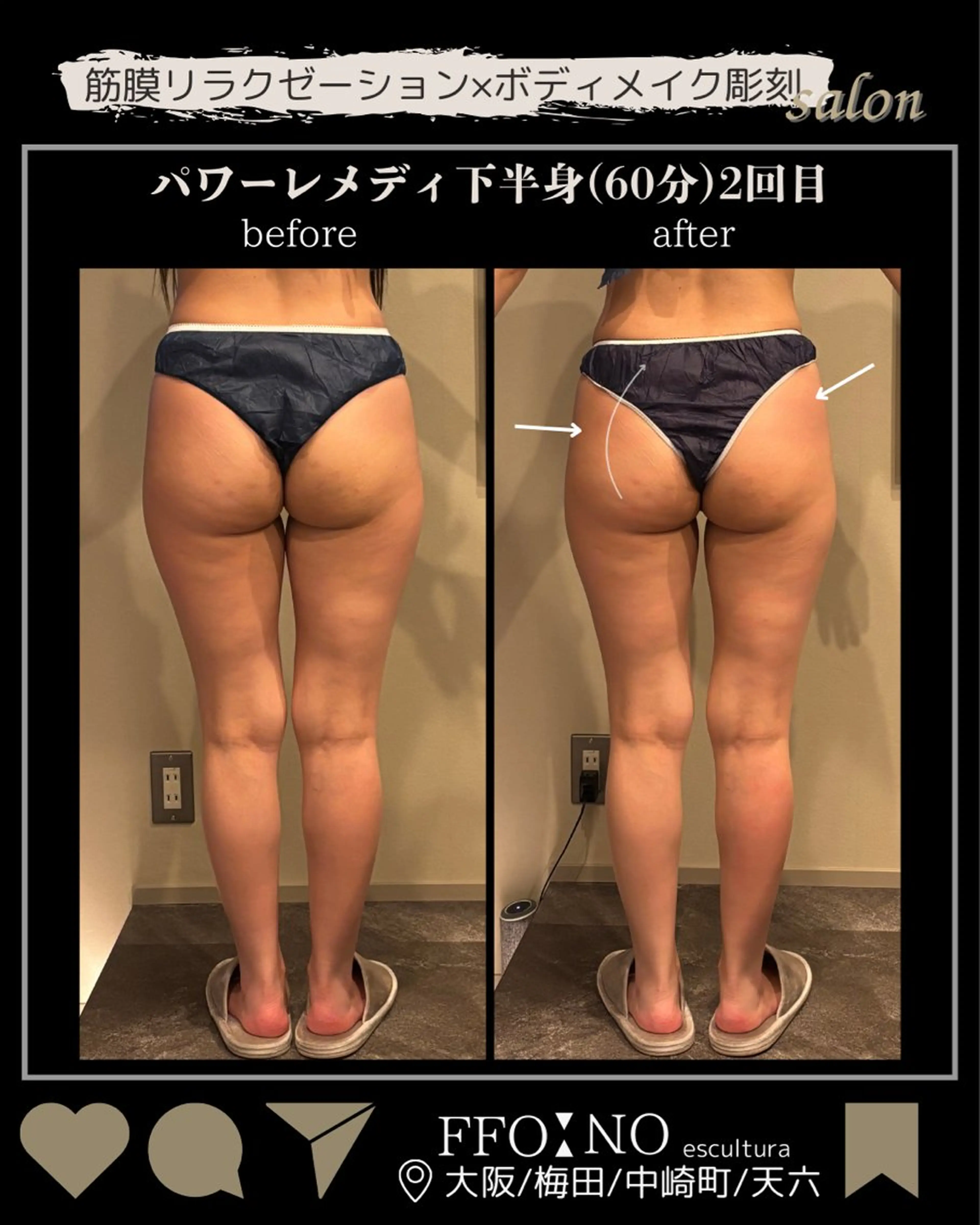 オフ:オン所属・オフ:オン 全身筋膜マッサージのエステ・リラクイメージ